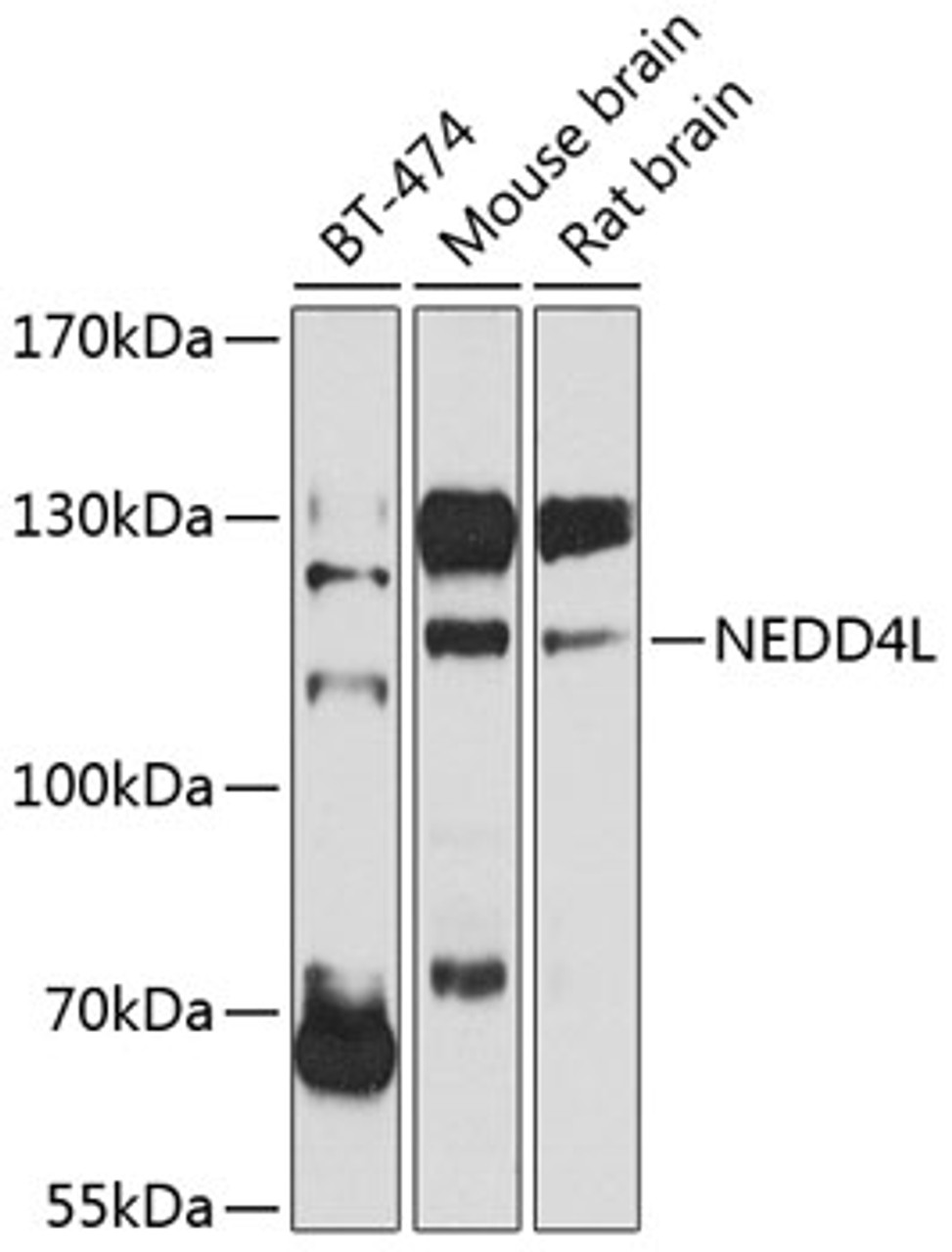 Western blot analysis of extracts of various cell lines, using NEDD4L antibody (23-389) at 1:1000 dilution.<br/>Secondary antibody: HRP Goat Anti-Rabbit IgG (H+L) at 1:10000 dilution.<br/>Lysates/proteins: 25ug per lane.<br/>Blocking buffer: 3% nonfat dry milk in TBST.<br/>Detection: ECL Basic Kit.<br/>Exposure time: 90s.