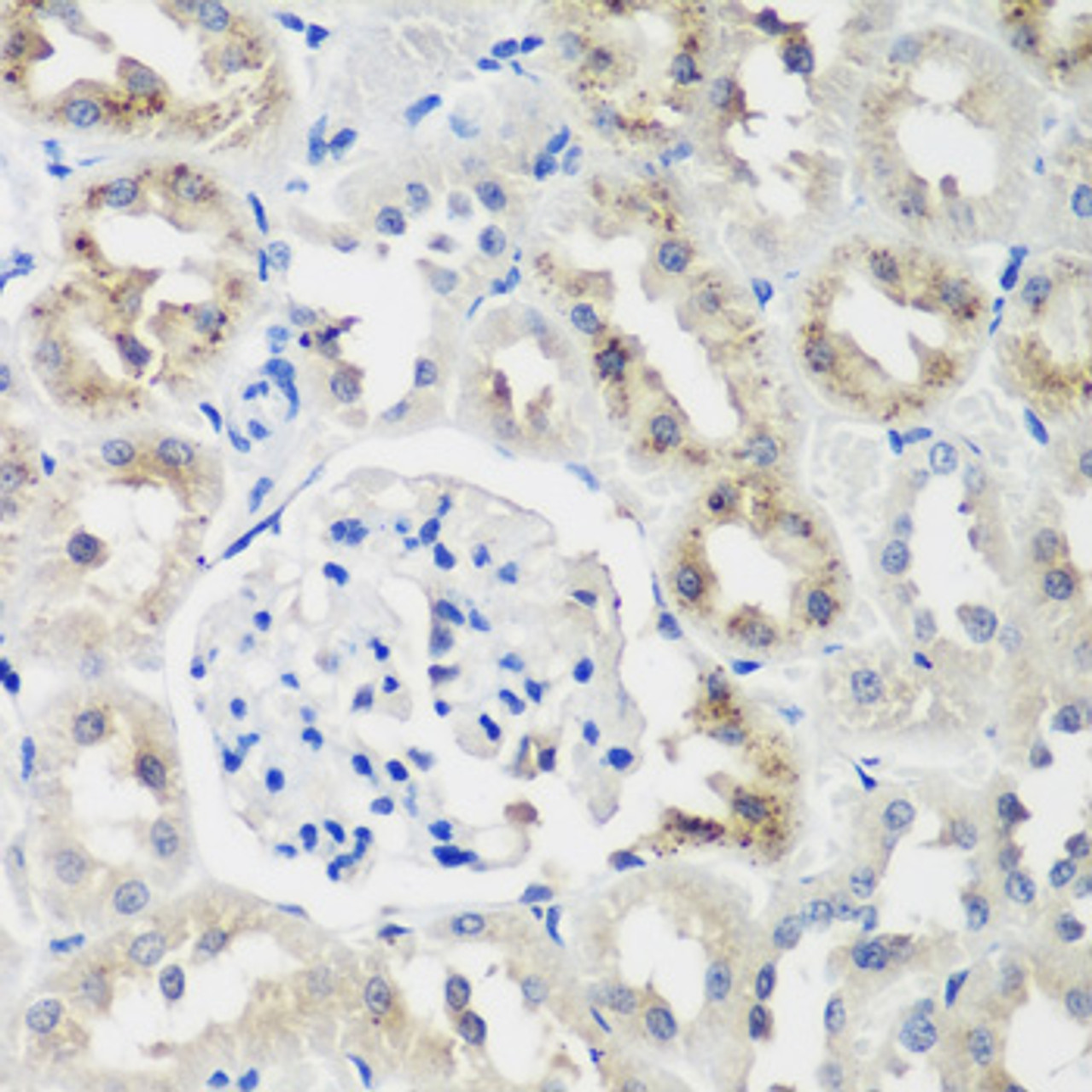 Immunohistochemistry of paraffin-embedded rat kidney using NEDD4L antibody (23-389) at dilution of 1:200 (40x lens) .