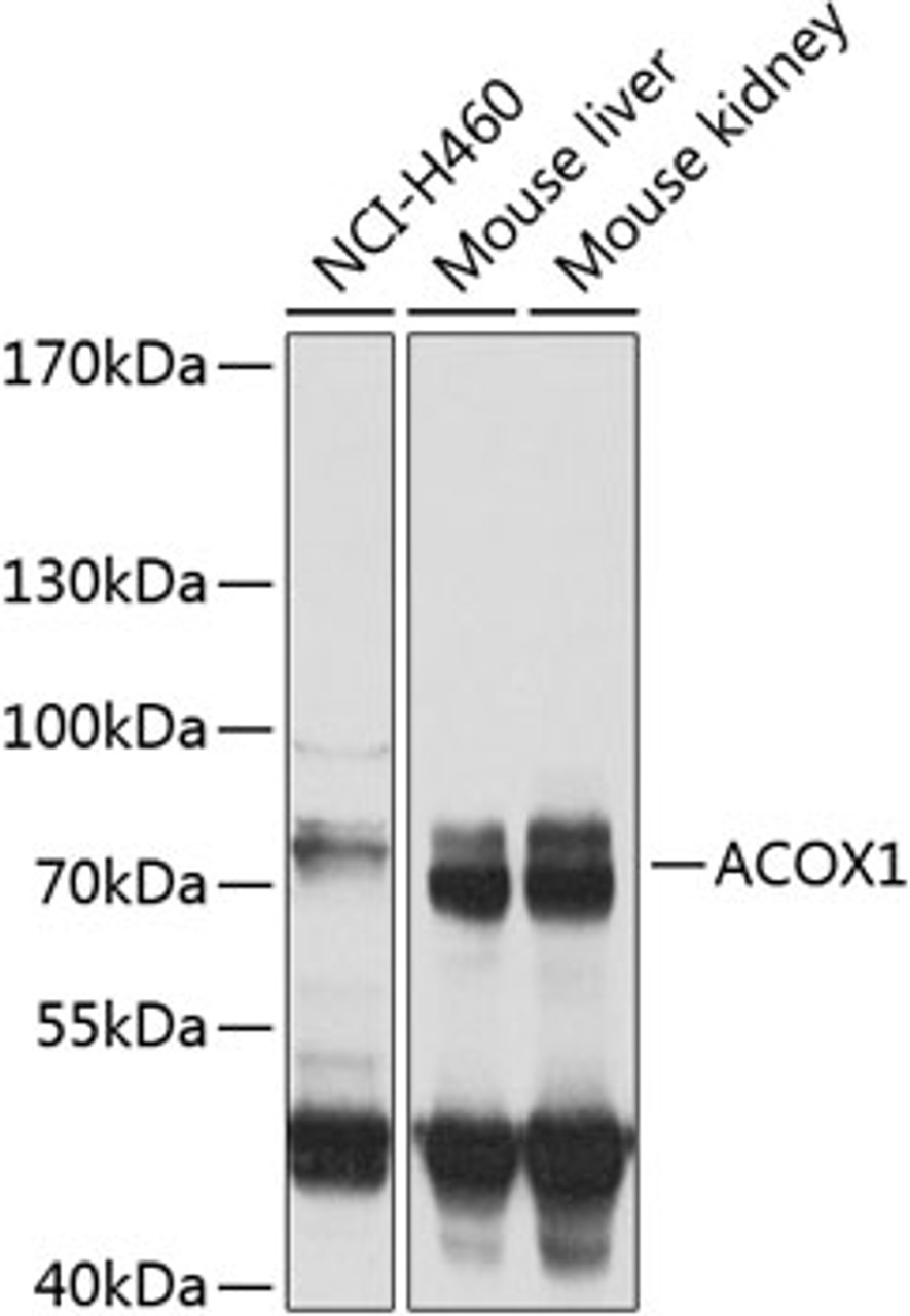 Western blot analysis of extracts of various cell lines, using ACOX1 antibody (23-395) at 1:1000 dilution.<br/>Secondary antibody: HRP Goat Anti-Rabbit IgG (H+L) at 1:10000 dilution.<br/>Lysates/proteins: 25ug per lane.<br/>Blocking buffer: 3% nonfat dry milk in TBST.<br/>Detection: ECL Basic Kit.<br/>Exposure time: 30s.