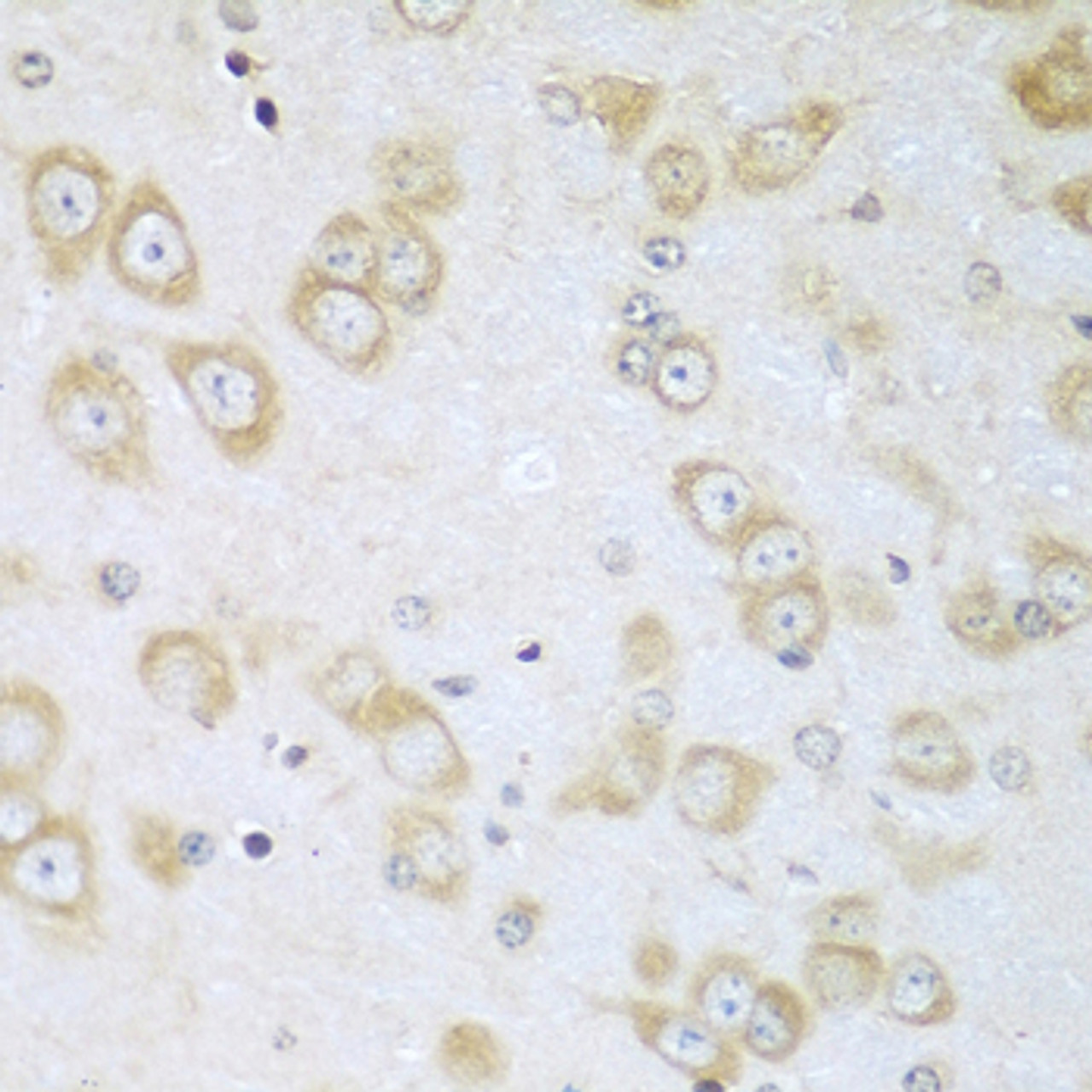 Immunohistochemistry of paraffin-embedded mouse brain using ACOX1 antibody (23-395) at dilution of 1:100 (40x lens) .