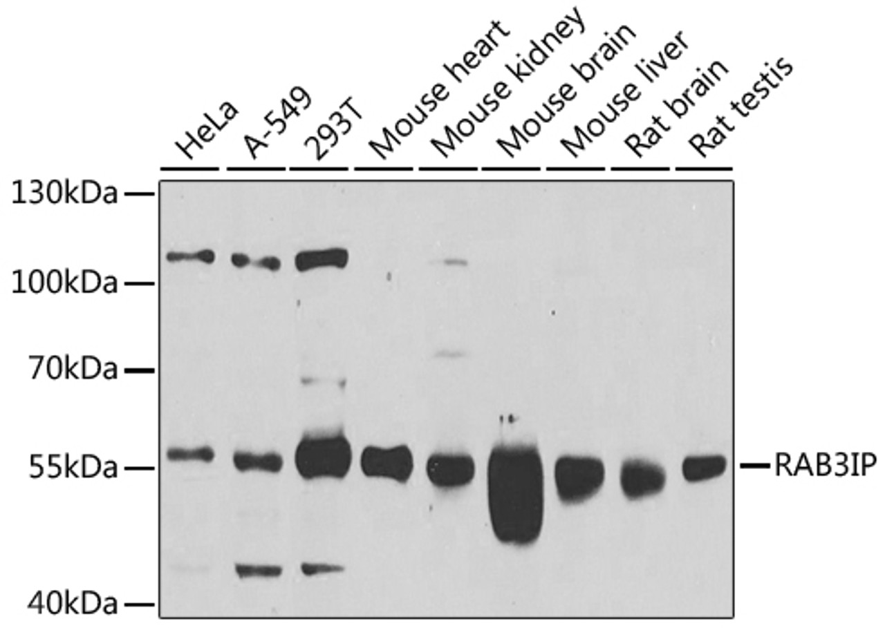 Western blot analysis of extracts of various cell lines, using RAB3IP antibody (23-396) at 1:1000 dilution.<br/>Secondary antibody: HRP Goat Anti-Rabbit IgG (H+L) at 1:10000 dilution.<br/>Lysates/proteins: 25ug per lane.<br/>Blocking buffer: 3% nonfat dry milk in TBST.<br/>Detection: ECL Basic Kit.<br/>Exposure time: 30s.