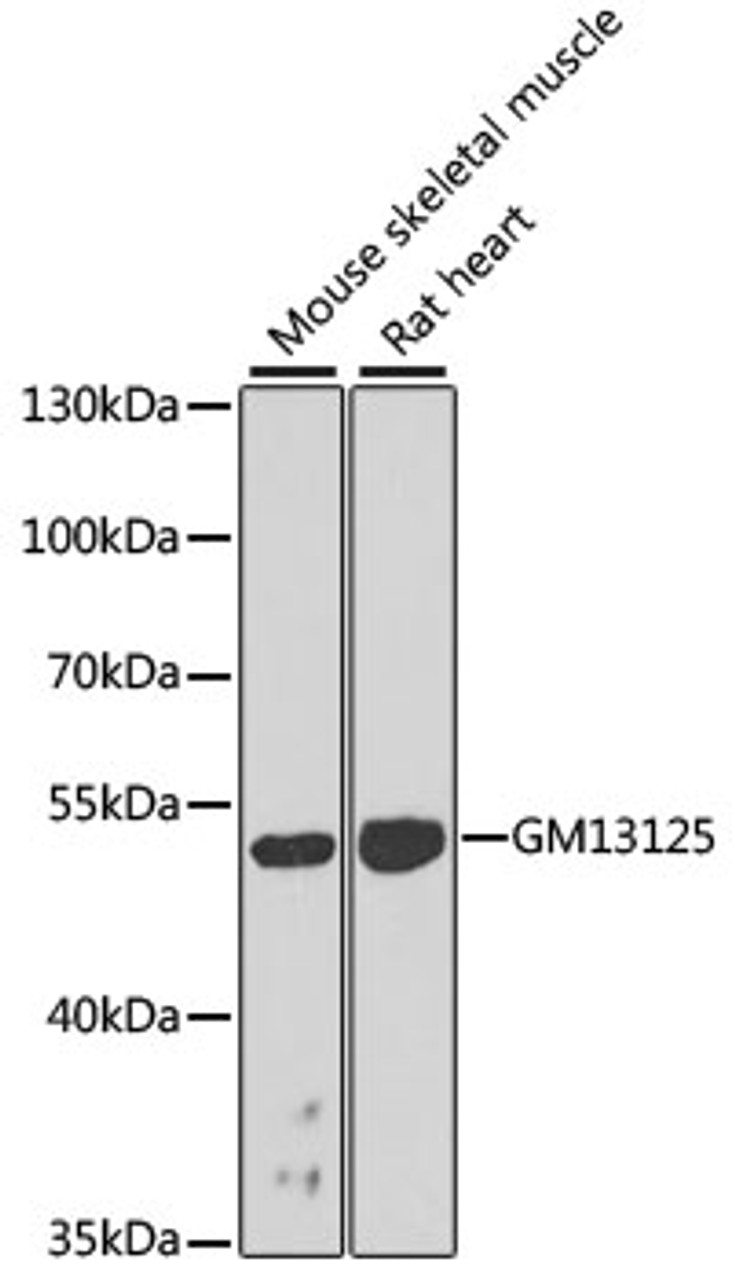 Western blot analysis of extracts of various cell lines, using Gm13125 antibody (23-397) at 1:1000 dilution.<br/>Secondary antibody: HRP Goat Anti-Rabbit IgG (H+L) at 1:10000 dilution.<br/>Lysates/proteins: 25ug per lane.<br/>Blocking buffer: 3% nonfat dry milk in TBST.<br/>Detection: ECL Basic Kit.<br/>Exposure time: 90s.