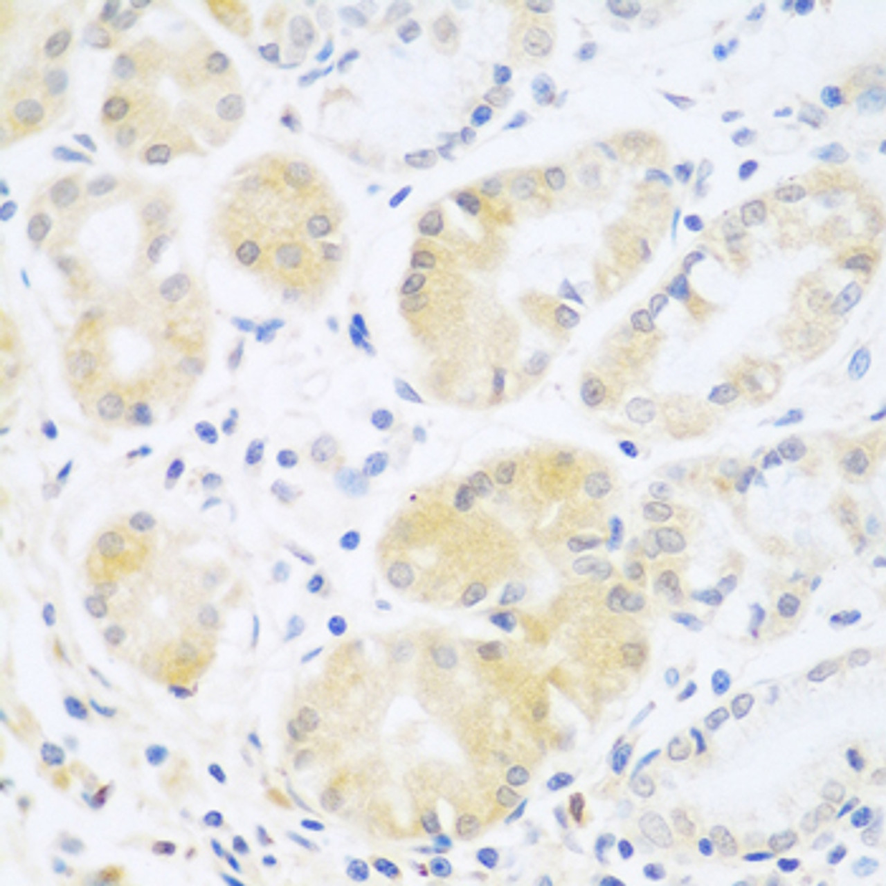 Immunohistochemistry of paraffin-embedded human stomach using C5 antibody (23-402) at dilution of 1:100 (40x lens) .