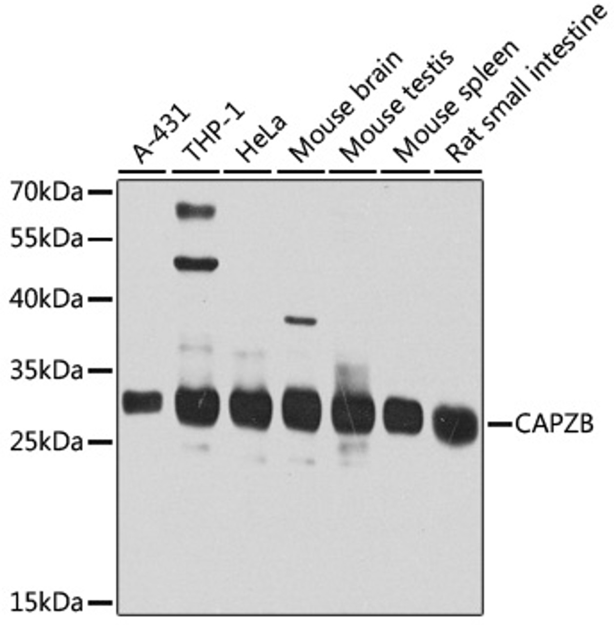 Western blot analysis of extracts of various cell lines, using CAPZB antibody (23-404) at 1:1000 dilution.<br/>Secondary antibody: HRP Goat Anti-Rabbit IgG (H+L) at 1:10000 dilution.<br/>Lysates/proteins: 25ug per lane.<br/>Blocking buffer: 3% nonfat dry milk in TBST.<br/>Detection: ECL Basic Kit.<br/>Exposure time: 30s.