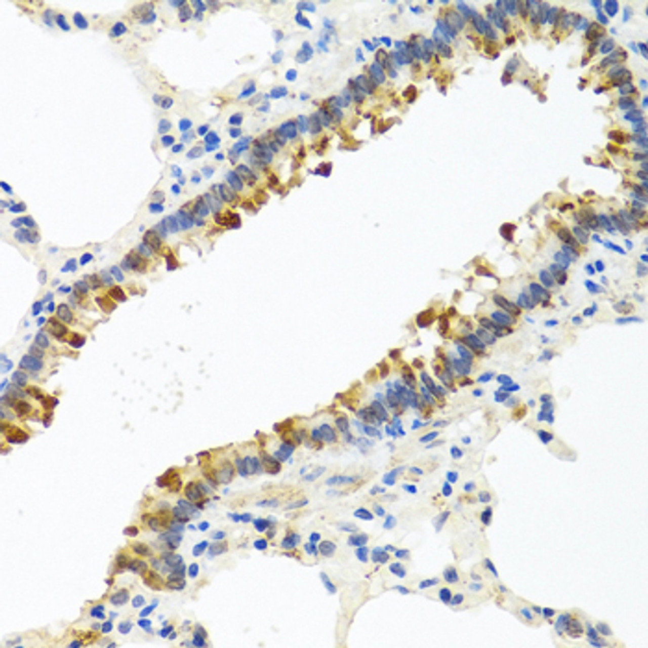 Immunohistochemistry of paraffin-embedded rat lung using CST4 antibody (23-410) at dilution of 1:100 (40x lens) .