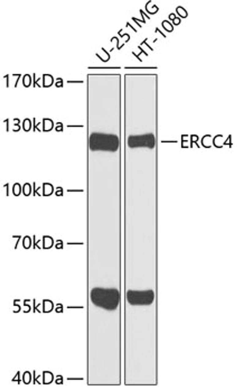 Western blot analysis of extracts of various cell lines, using ERCC4 antibody (23-413) at 1:1000 dilution.<br/>Secondary antibody: HRP Goat Anti-Rabbit IgG (H+L) at 1:10000 dilution.<br/>Lysates/proteins: 25ug per lane.<br/>Blocking buffer: 3% nonfat dry milk in TBST.<br/>Detection: ECL Basic Kit.<br/>Exposure time: 30s.