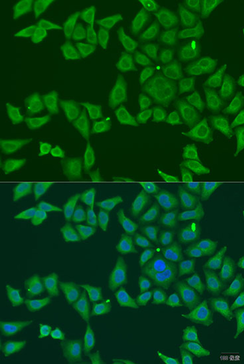 Immunofluorescence analysis of U2OS cells using FKBP2 antibody (23-414) at dilution of 1:100. Blue: DAPI for nuclear staining.
