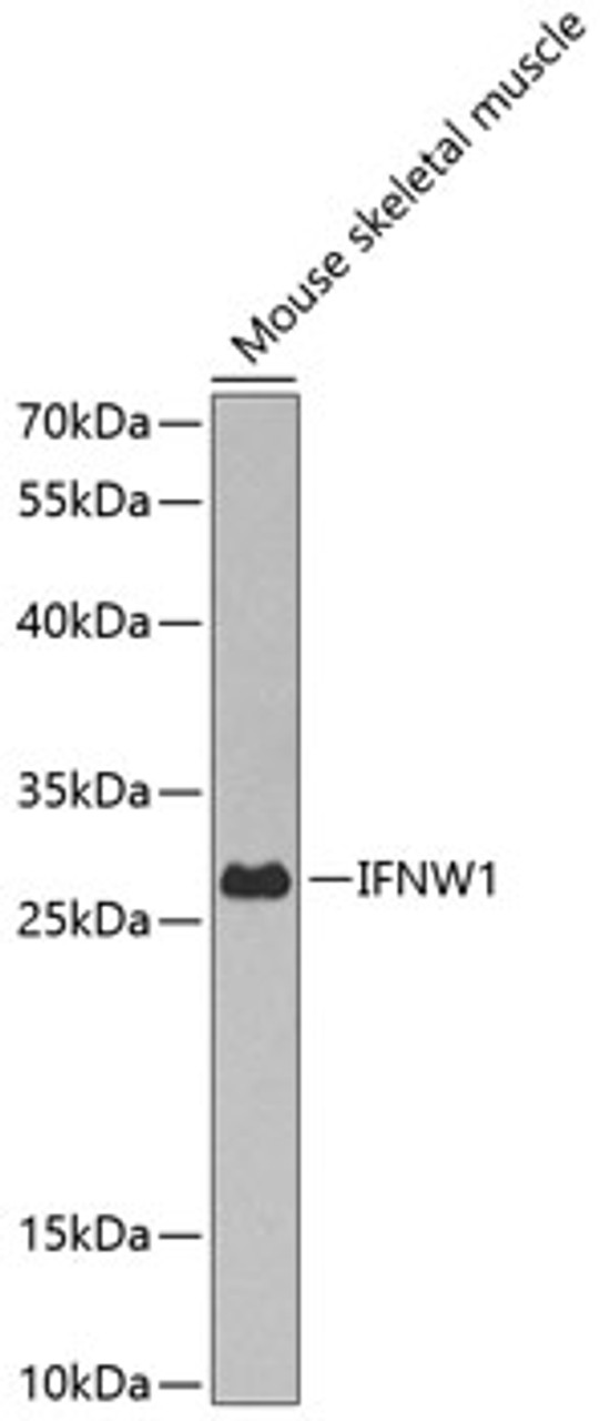 Western blot analysis of extracts of mouse skeletal muscle, using IFNW1 antibody (23-417) at 1:1000 dilution.<br/>Secondary antibody: HRP Goat Anti-Rabbit IgG (H+L) at 1:10000 dilution.<br/>Lysates/proteins: 25ug per lane.<br/>Blocking buffer: 3% nonfat dry milk in TBST.<br/>Detection: ECL Basic Kit.<br/>Exposure time: 90s.
