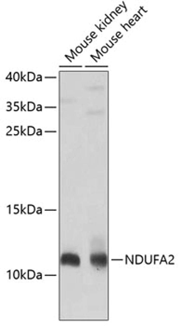 Western blot analysis of extracts of various cell lines, using NDUFA2 antibody (23-424) at 1:1000 dilution.<br/>Secondary antibody: HRP Goat Anti-Rabbit IgG (H+L) at 1:10000 dilution.<br/>Lysates/proteins: 25ug per lane.<br/>Blocking buffer: 3% nonfat dry milk in TBST.<br/>Detection: ECL Basic Kit.<br/>Exposure time: 30s.