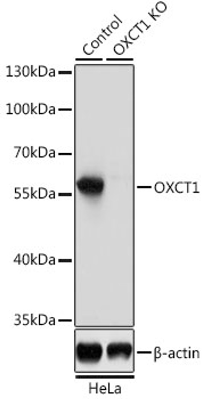 Western blot analysis of extracts from normal (control) and OXCT1 knockout (KO) HeLa cells, using OXCT1 antibody (23-426) at 1:3000 dilution.<br/>Secondary antibody: HRP Goat Anti-Rabbit IgG (H+L) at 1:10000 dilution.<br/>Lysates/proteins: 25ug per lane.<br/>Blocking buffer: 3% nonfat dry milk in TBST.<br/>Detection: ECL Basic Kit.<br/>Exposure time: 1s.