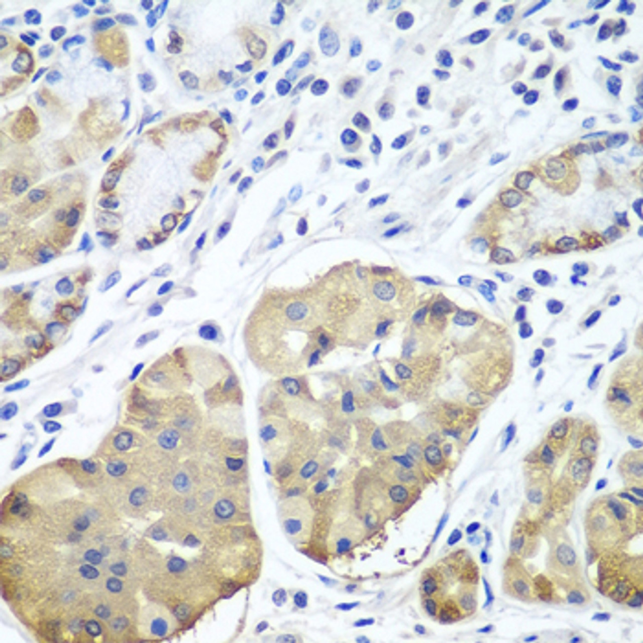 Immunohistochemistry of paraffin-embedded human stomach using PLCB2 antibody (23-428) at dilution of 1:100 (40x lens) .