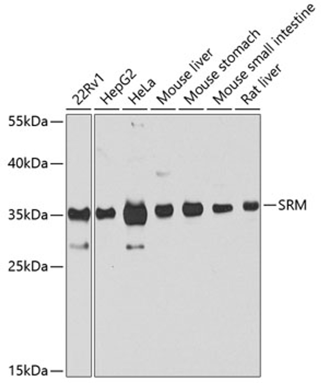 Western blot analysis of extracts of various cell lines, using SRM antibody (23-435) at 1:1000 dilution.<br/>Secondary antibody: HRP Goat Anti-Rabbit IgG (H+L) at 1:10000 dilution.<br/>Lysates/proteins: 25ug per lane.<br/>Blocking buffer: 3% nonfat dry milk in TBST.<br/>Detection: ECL Basic Kit.<br/>Exposure time: 10s.