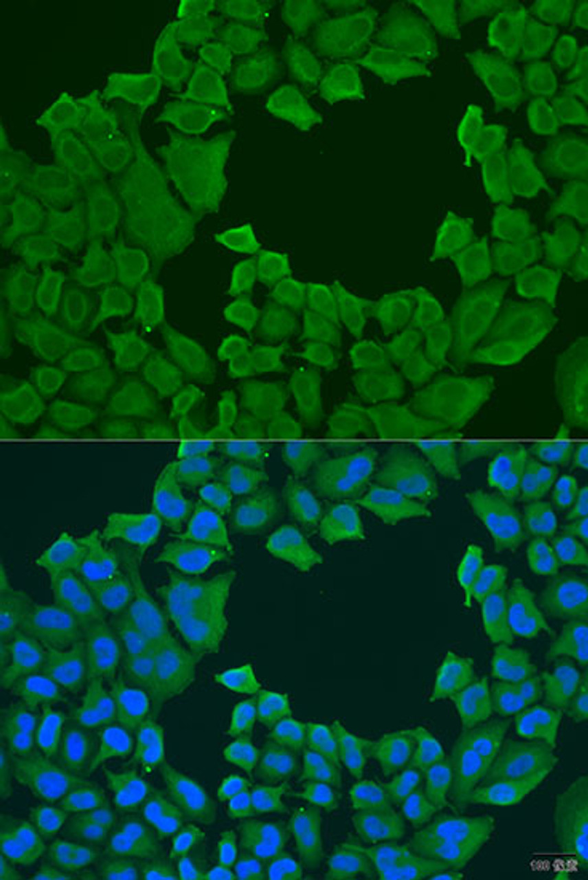 Immunofluorescence analysis of U2OS cells using STXBP3 antibody (23-436) at dilution of 1:100. Blue: DAPI for nuclear staining.