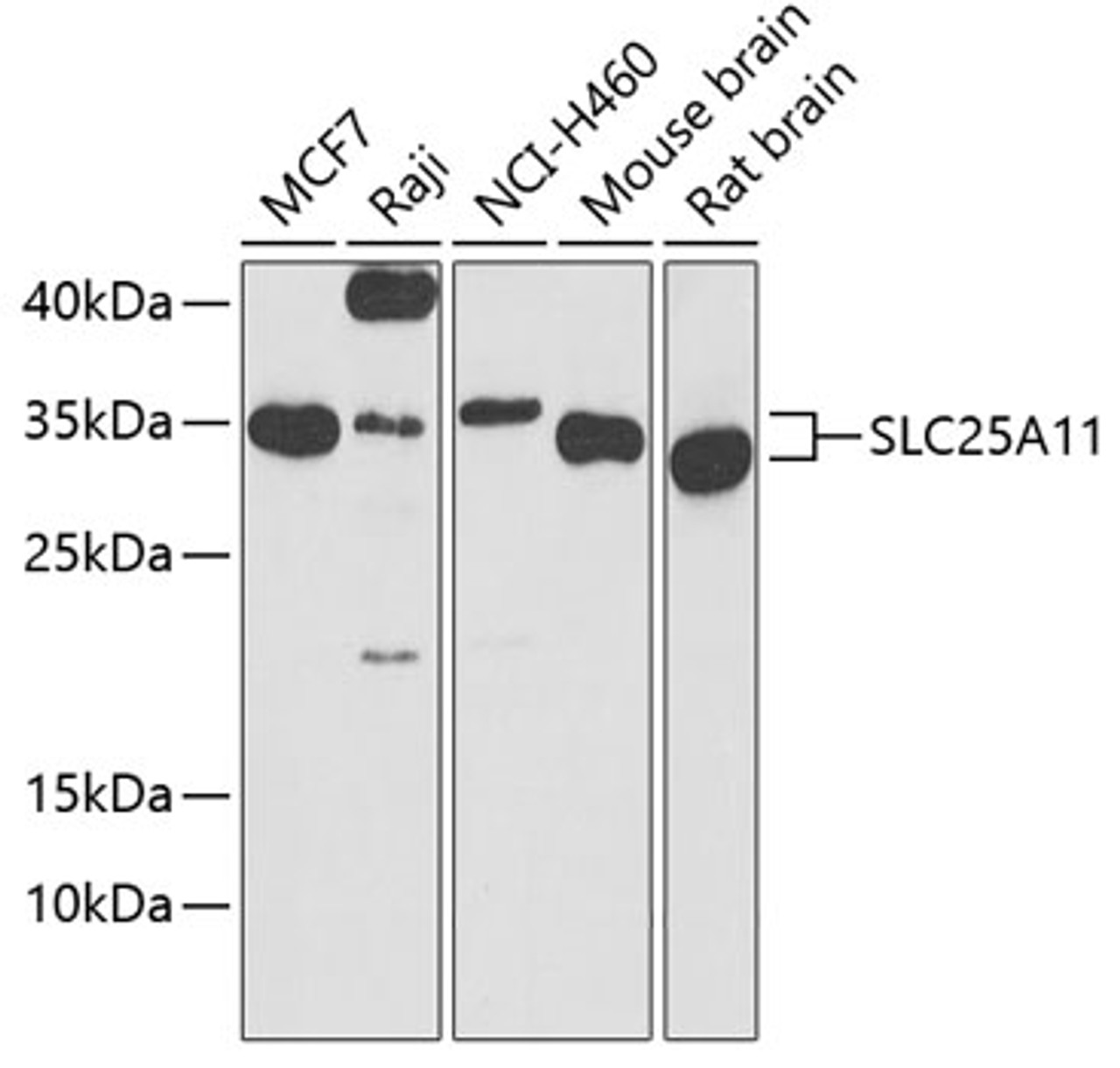 Western blot analysis of extracts of various cell lines, using SLC25A11 antibody (23-441) at 1:1000 dilution.<br/>Secondary antibody: HRP Goat Anti-Rabbit IgG (H+L) at 1:10000 dilution.<br/>Lysates/proteins: 25ug per lane.<br/>Blocking buffer: 3% nonfat dry milk in TBST.<br/>Detection: ECL Basic Kit.<br/>Exposure time: 10s.