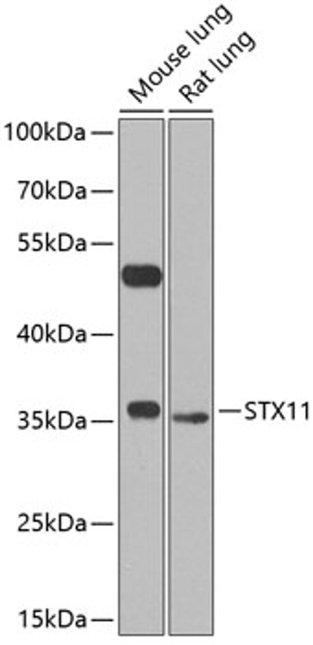 Western blot analysis of extracts of various cell lines, using STX11 antibody (23-443) at 1:1000 dilution.<br/>Secondary antibody: HRP Goat Anti-Rabbit IgG (H+L) at 1:10000 dilution.<br/>Lysates/proteins: 25ug per lane.<br/>Blocking buffer: 3% nonfat dry milk in TBST.<br/>Detection: ECL Basic Kit.<br/>Exposure time: 45s.