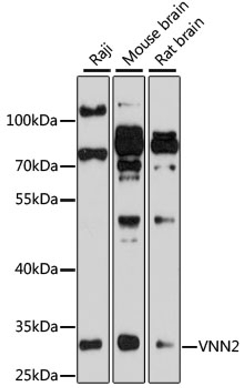 Western blot analysis of extracts of various cell lines, using VNN2 antibody (23-444) at 1:1000 dilution.<br/>Secondary antibody: HRP Goat Anti-Rabbit IgG (H+L) at 1:10000 dilution.<br/>Lysates/proteins: 25ug per lane.<br/>Blocking buffer: 3% nonfat dry milk in TBST.<br/>Detection: ECL Basic Kit.<br/>Exposure time: 90s.