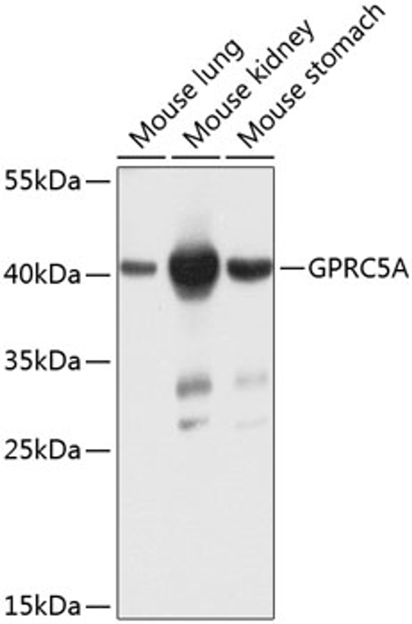 Western blot analysis of extracts of various cell lines, using GPRC5A antibody (23-445) at 1:1000 dilution.<br/>Secondary antibody: HRP Goat Anti-Rabbit IgG (H+L) at 1:10000 dilution.<br/>Lysates/proteins: 25ug per lane.<br/>Blocking buffer: 3% nonfat dry milk in TBST.<br/>Detection: ECL Basic Kit.<br/>Exposure time: 15s.