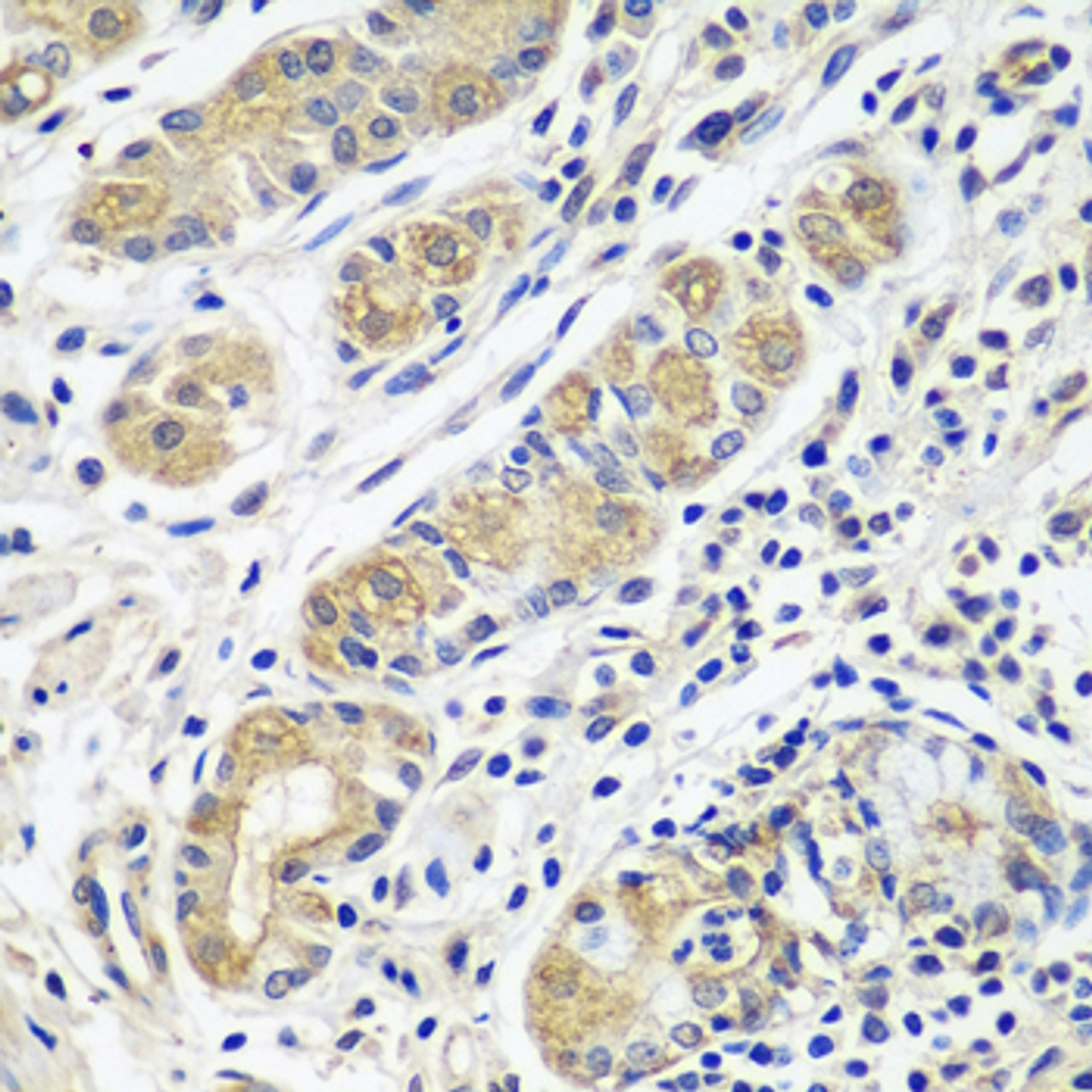 Immunohistochemistry of paraffin-embedded human stomach using GPRC5A antibody (23-445) at dilution of 1:100 (40x lens) .