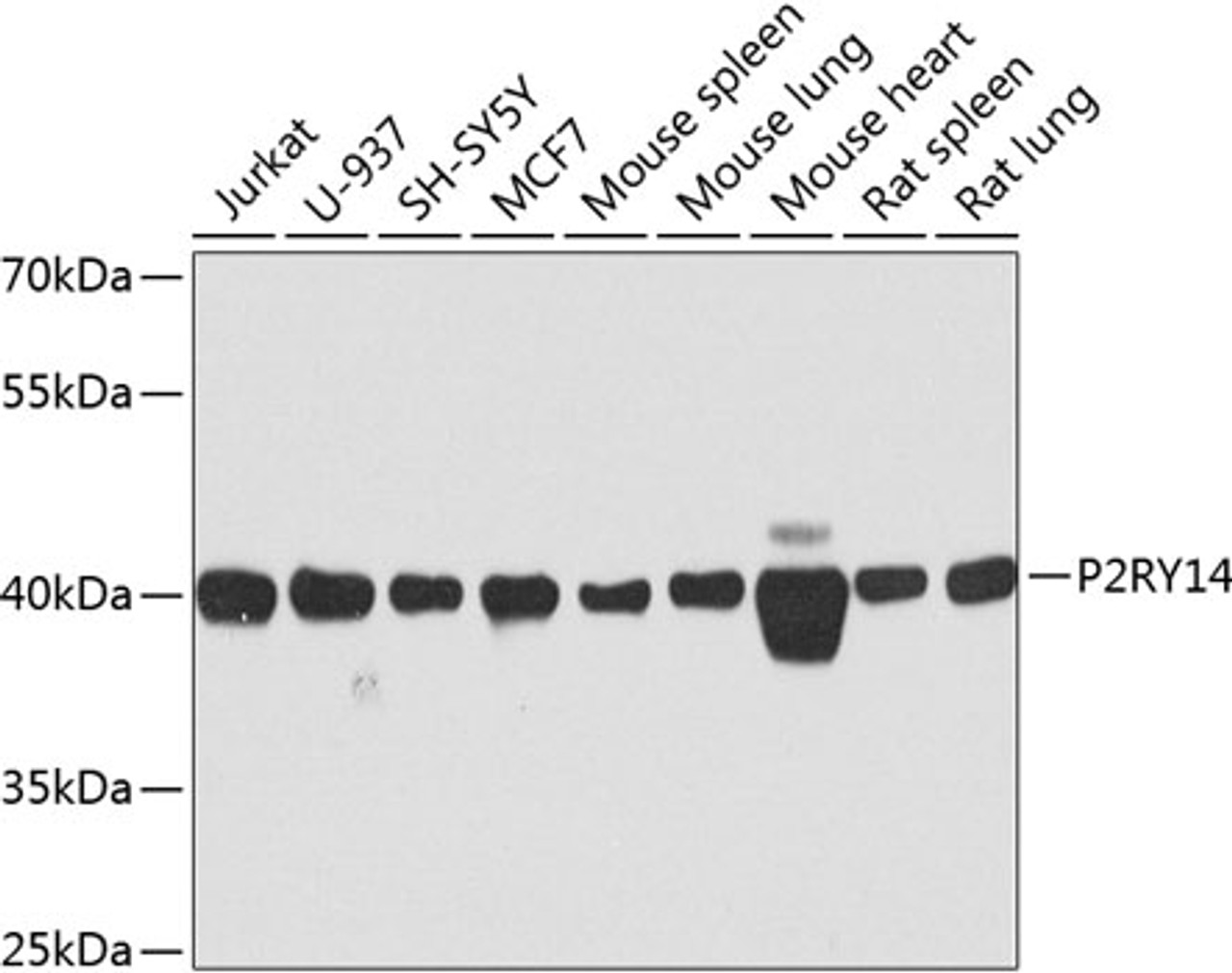 Western blot analysis of extracts of various cell lines, using P2RY14 antibody (23-446) at 1:1000 dilution.<br/>Secondary antibody: HRP Goat Anti-Rabbit IgG (H+L) at 1:10000 dilution.<br/>Lysates/proteins: 25ug per lane.<br/>Blocking buffer: 3% nonfat dry milk in TBST.<br/>Detection: ECL Basic Kit.<br/>Exposure time: 90s.