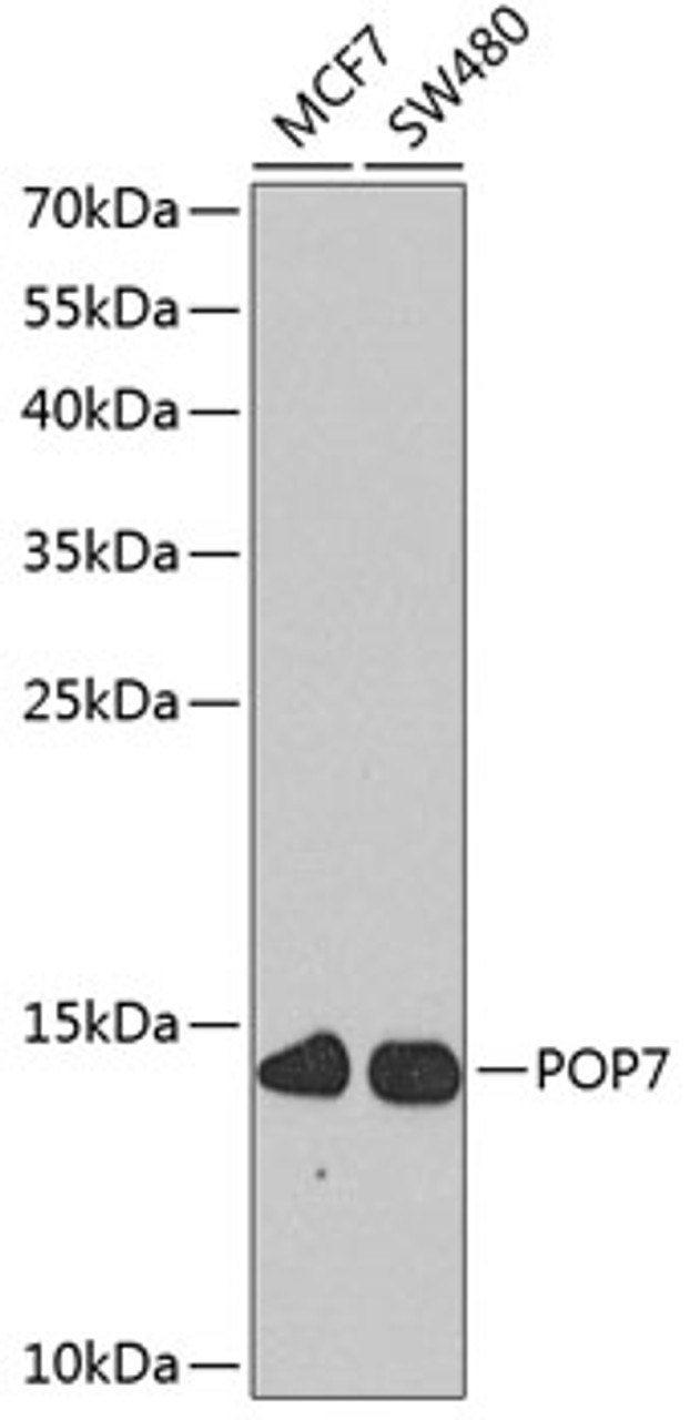 Western blot analysis of extracts of various cell lines, using POP7 antibody (23-449) at 1:1000 dilution.<br/>Secondary antibody: HRP Goat Anti-Rabbit IgG (H+L) at 1:10000 dilution.<br/>Lysates/proteins: 25ug per lane.<br/>Blocking buffer: 3% nonfat dry milk in TBST.<br/>Detection: ECL Basic Kit.<br/>Exposure time: 90s.