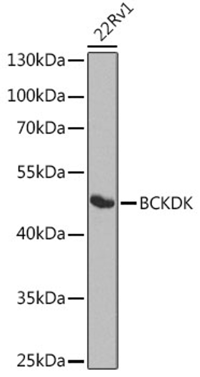 Western blot analysis of extracts of various cell lines, using BCKDK antibody (23-450) at 1:1000 dilution.<br/>Secondary antibody: HRP Goat Anti-Rabbit IgG (H+L) at 1:10000 dilution.<br/>Lysates/proteins: 25ug per lane.<br/>Blocking buffer: 3% nonfat dry milk in TBST.<br/>Detection: ECL Basic Kit.<br/>Exposure time: 90s.