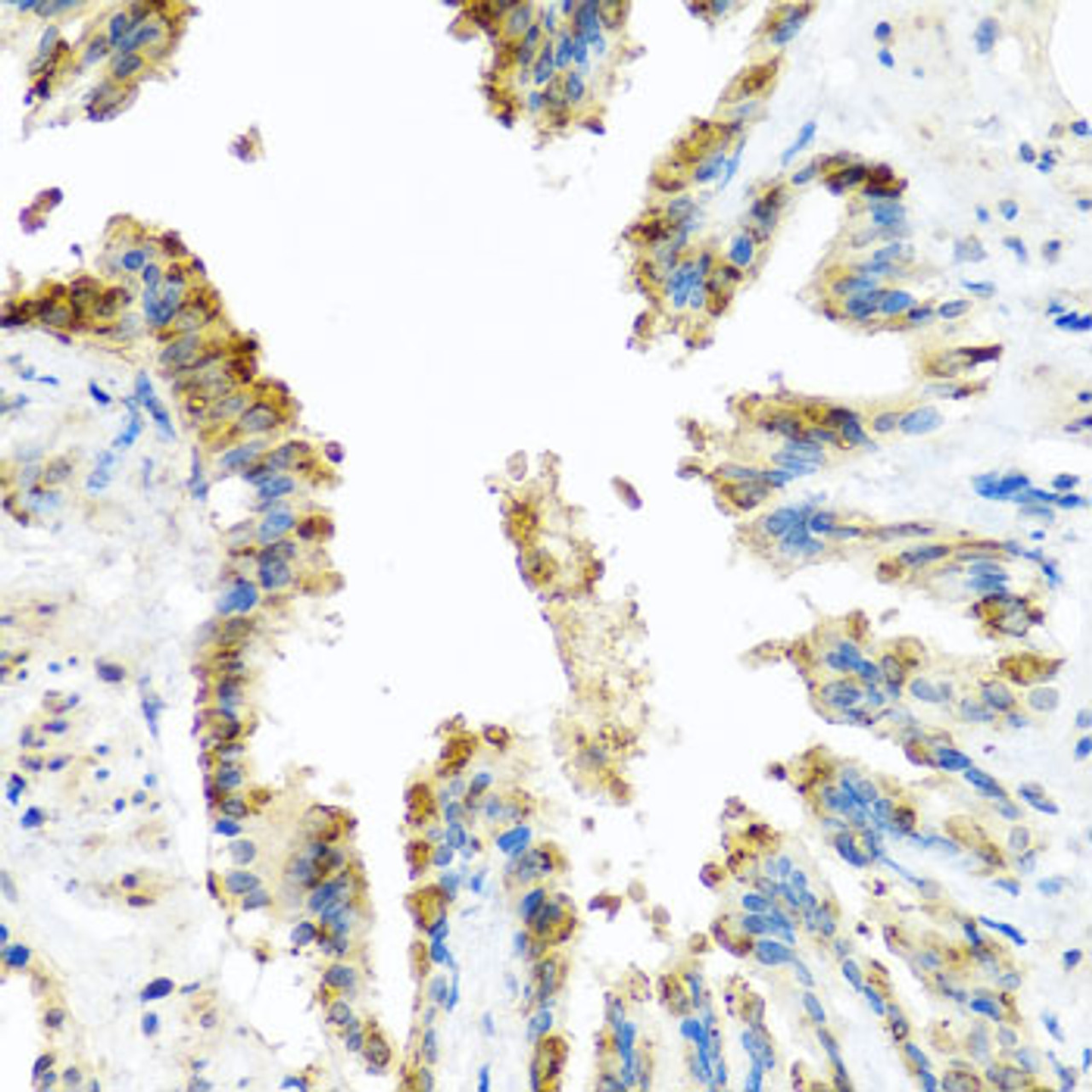 Immunohistochemistry of paraffin-embedded rat lung using BCKDK antibody (23-450) at dilution of 1:100 (40x lens) .