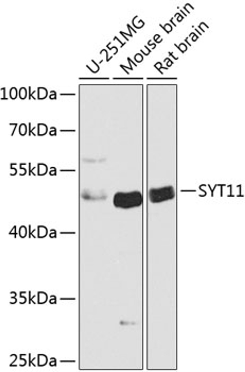 Western blot analysis of extracts of various cell lines, using SYT11 antibody (23-456) at 1:1000 dilution.<br/>Secondary antibody: HRP Goat Anti-Rabbit IgG (H+L) at 1:10000 dilution.<br/>Lysates/proteins: 25ug per lane.<br/>Blocking buffer: 3% nonfat dry milk in TBST.<br/>Detection: ECL Basic Kit.<br/>Exposure time: 30s.