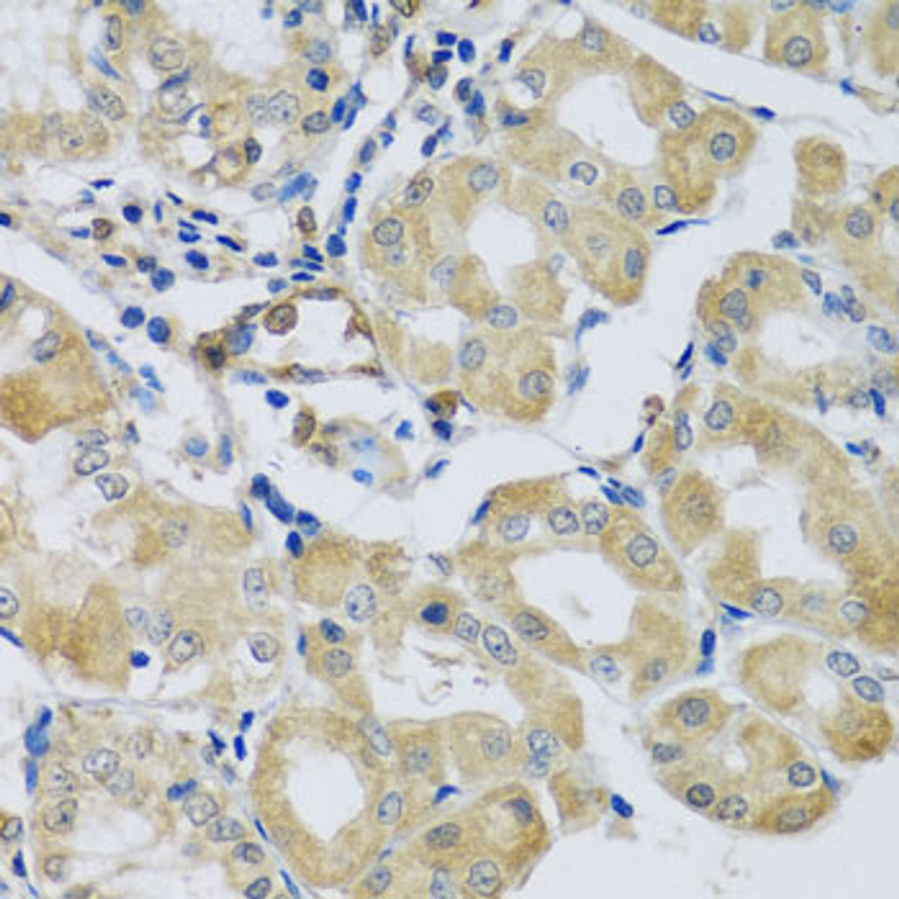 Immunohistochemistry of paraffin-embedded human stomach using SYT11 antibody (23-456) at dilution of 1:100 (40x lens) .