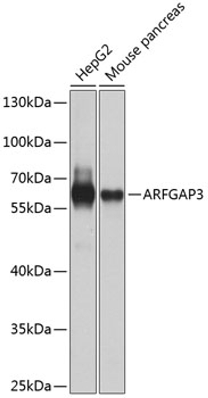 Western blot analysis of extracts of various cell lines, using ARFGAP3 antibody (23-461) at 1:1000 dilution.<br/>Secondary antibody: HRP Goat Anti-Rabbit IgG (H+L) at 1:10000 dilution.<br/>Lysates/proteins: 25ug per lane.<br/>Blocking buffer: 3% nonfat dry milk in TBST.<br/>Detection: ECL Basic Kit.<br/>Exposure time: 30s.