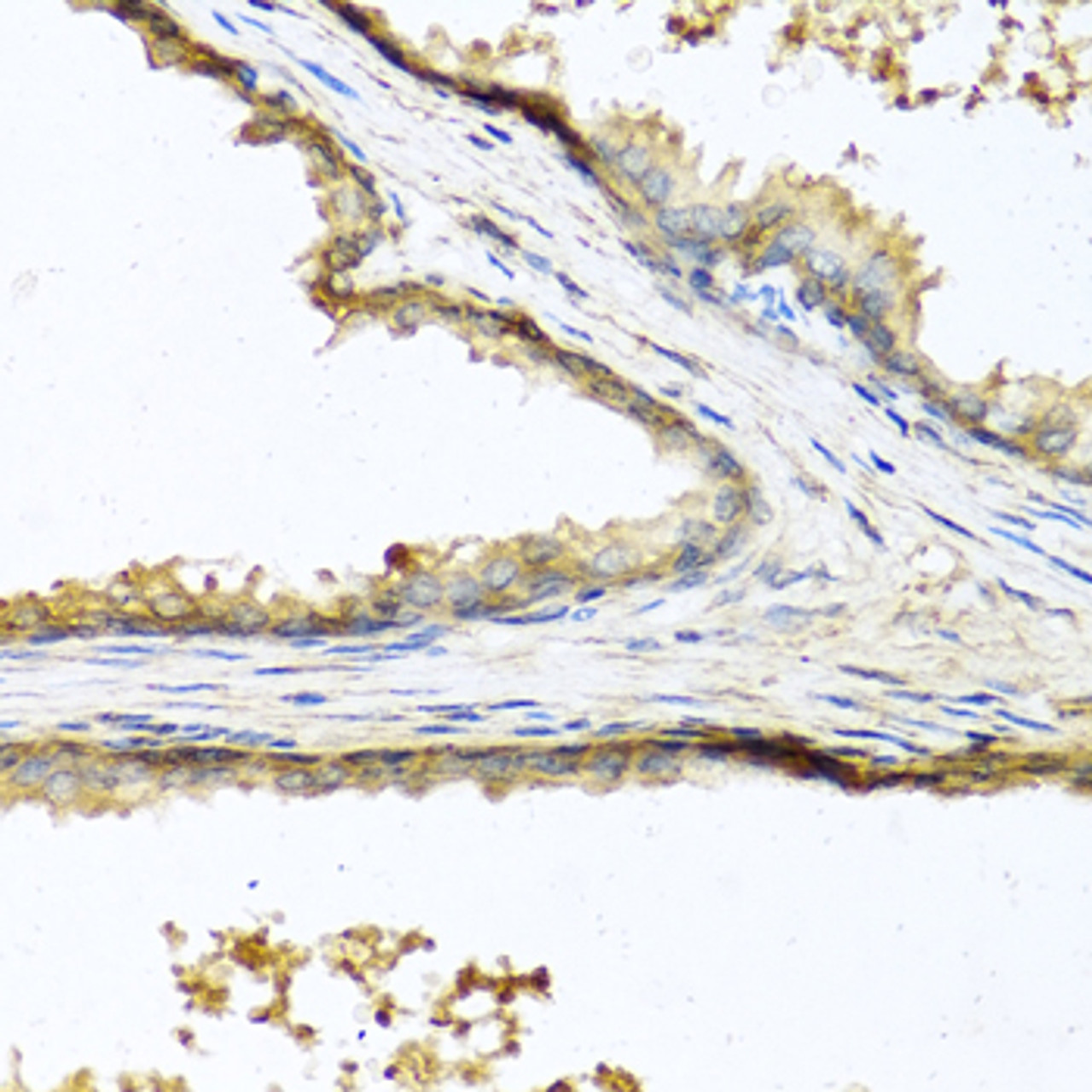 Immunohistochemistry of paraffin-embedded human prostate using SOST antibody (23-464) at dilution of 1:100 (40x lens) .