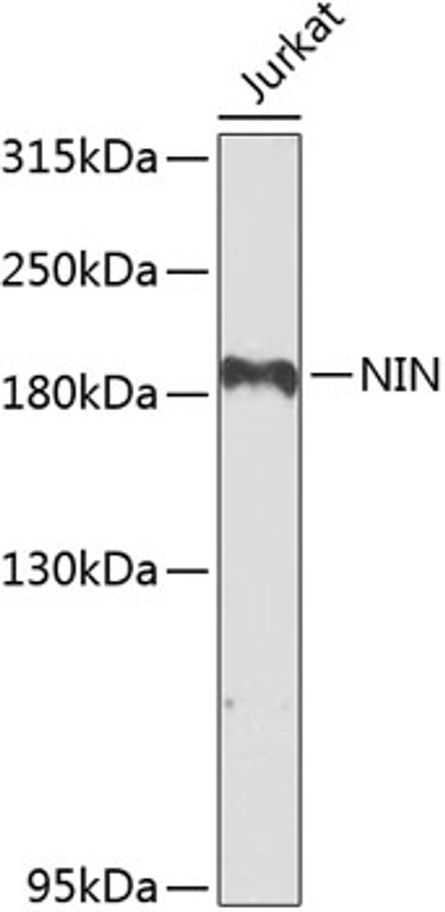 Western blot analysis of extracts of Jurkat cells, using NIN antibody (23-465) at 1:1000 dilution._Secondary antibody: HRP Goat Anti-Rabbit IgG (H+L) at 1:10000 dilution._Lysates/proteins: 25ug per lane._Blocking buffer: 3% nonfat dry milk in TBST._Detection: ECL Enhanced Kit._Exposure time: 90s.