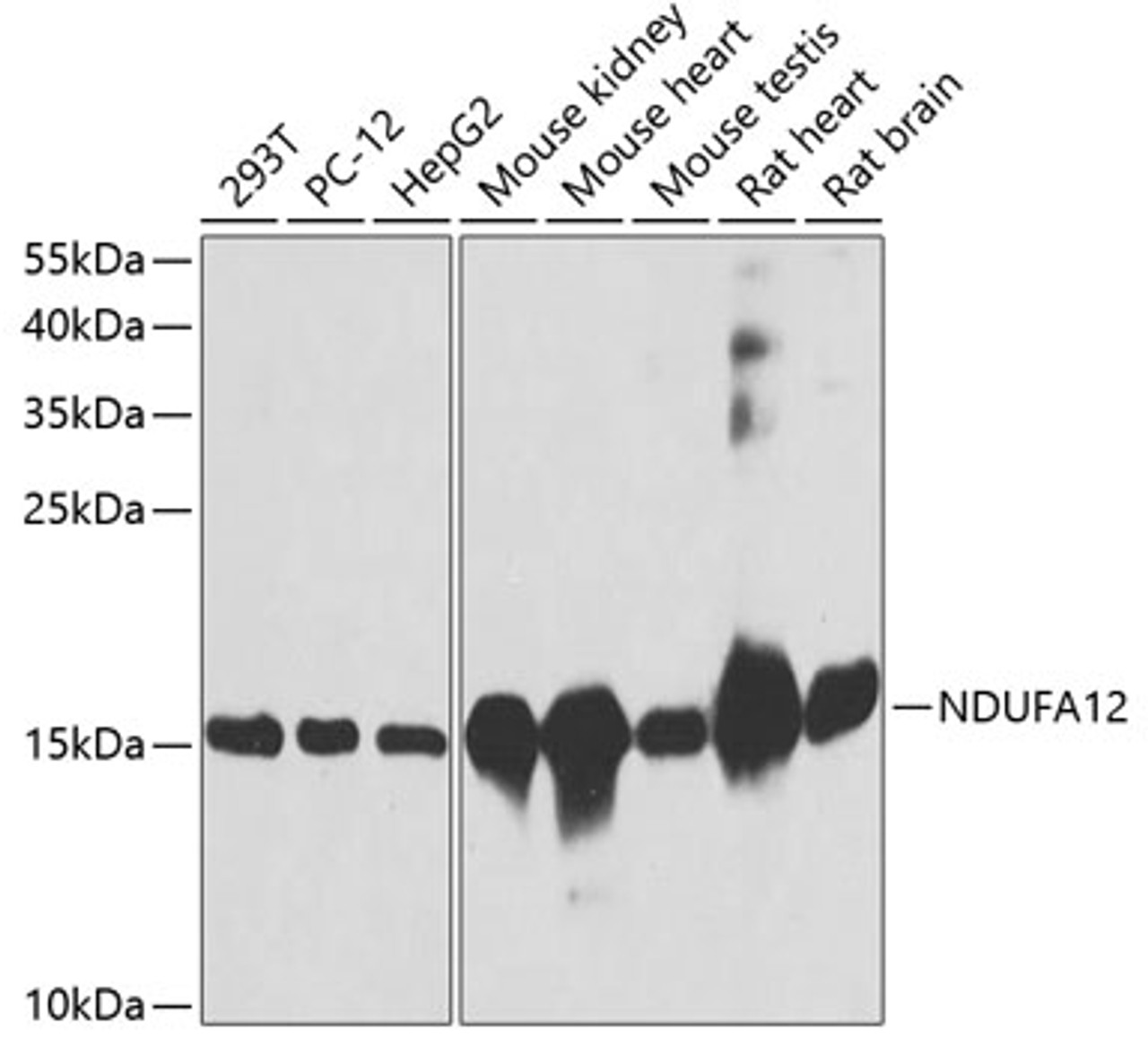 Western blot analysis of extracts of various cell lines, using NDUFA12 antibody (23-473) at 1:3000 dilution.<br/>Secondary antibody: HRP Goat Anti-Rabbit IgG (H+L) at 1:10000 dilution.<br/>Lysates/proteins: 25ug per lane.<br/>Blocking buffer: 3% nonfat dry milk in TBST.<br/>Detection: ECL Basic Kit.<br/>Exposure time: 30s.