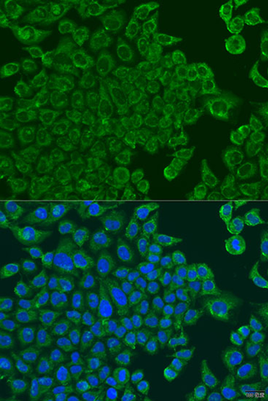 Immunofluorescence analysis of U2OS cells using ALOXE3 antibody (23-475) at dilution of 1:100. Blue: DAPI for nuclear staining.