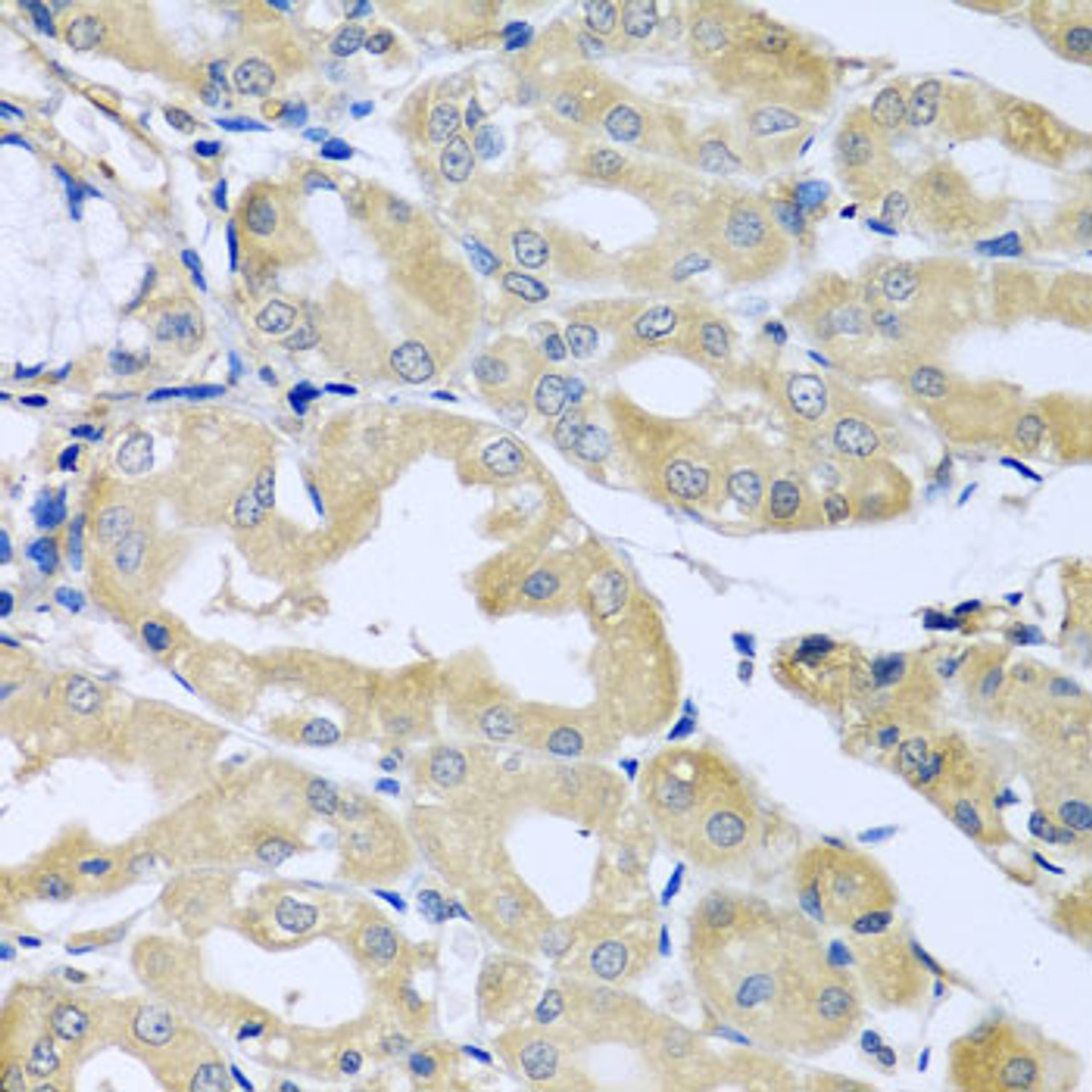 Immunohistochemistry of paraffin-embedded human stomach using HS1BP3 antibody (23-477) at dilution of 1:100 (40x lens) .