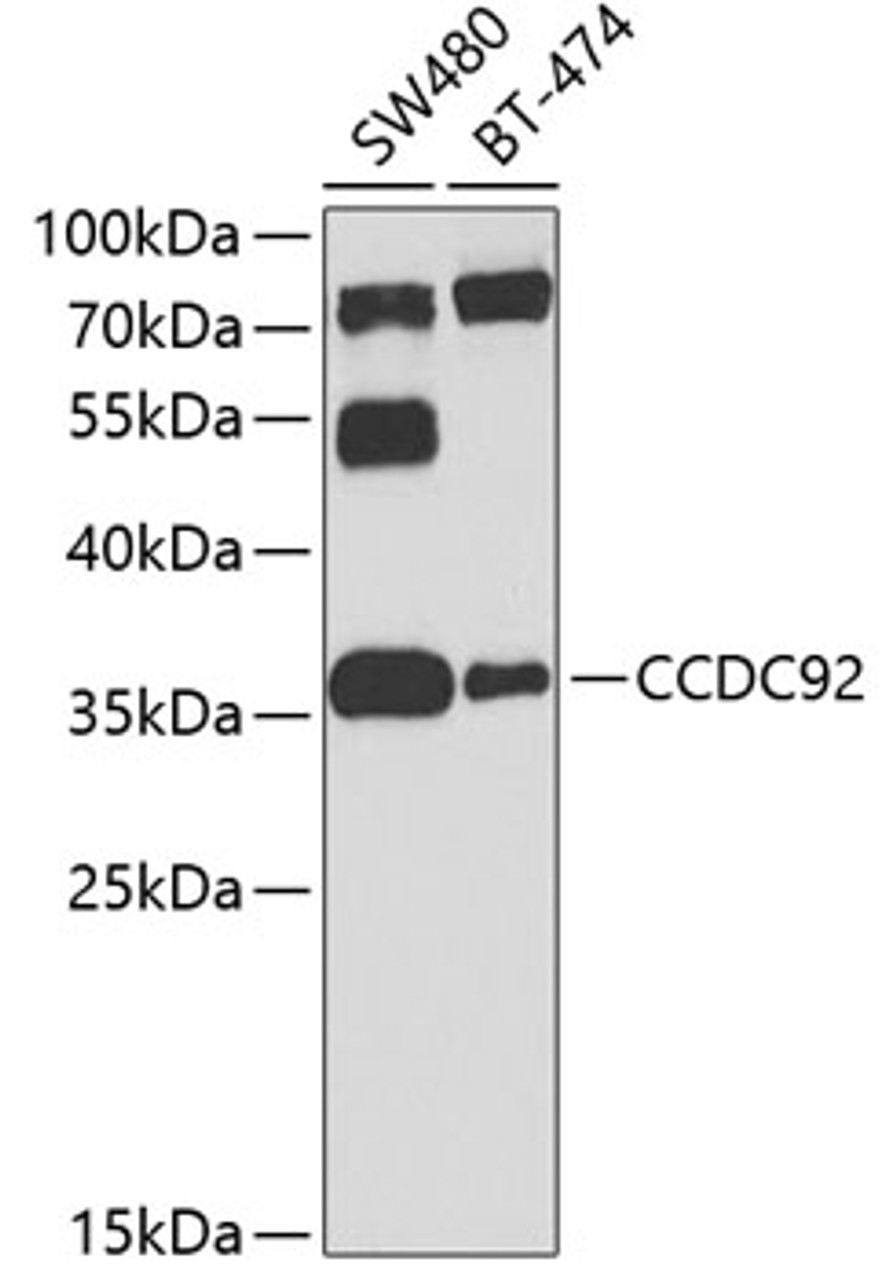 Western blot analysis of extracts of various cell lines, using CCDC92 antibody (23-481) at 1:1000 dilution.<br/>Secondary antibody: HRP Goat Anti-Rabbit IgG (H+L) at 1:10000 dilution.<br/>Lysates/proteins: 25ug per lane.<br/>Blocking buffer: 3% nonfat dry milk in TBST.<br/>Detection: ECL Basic Kit.<br/>Exposure time: 60s.