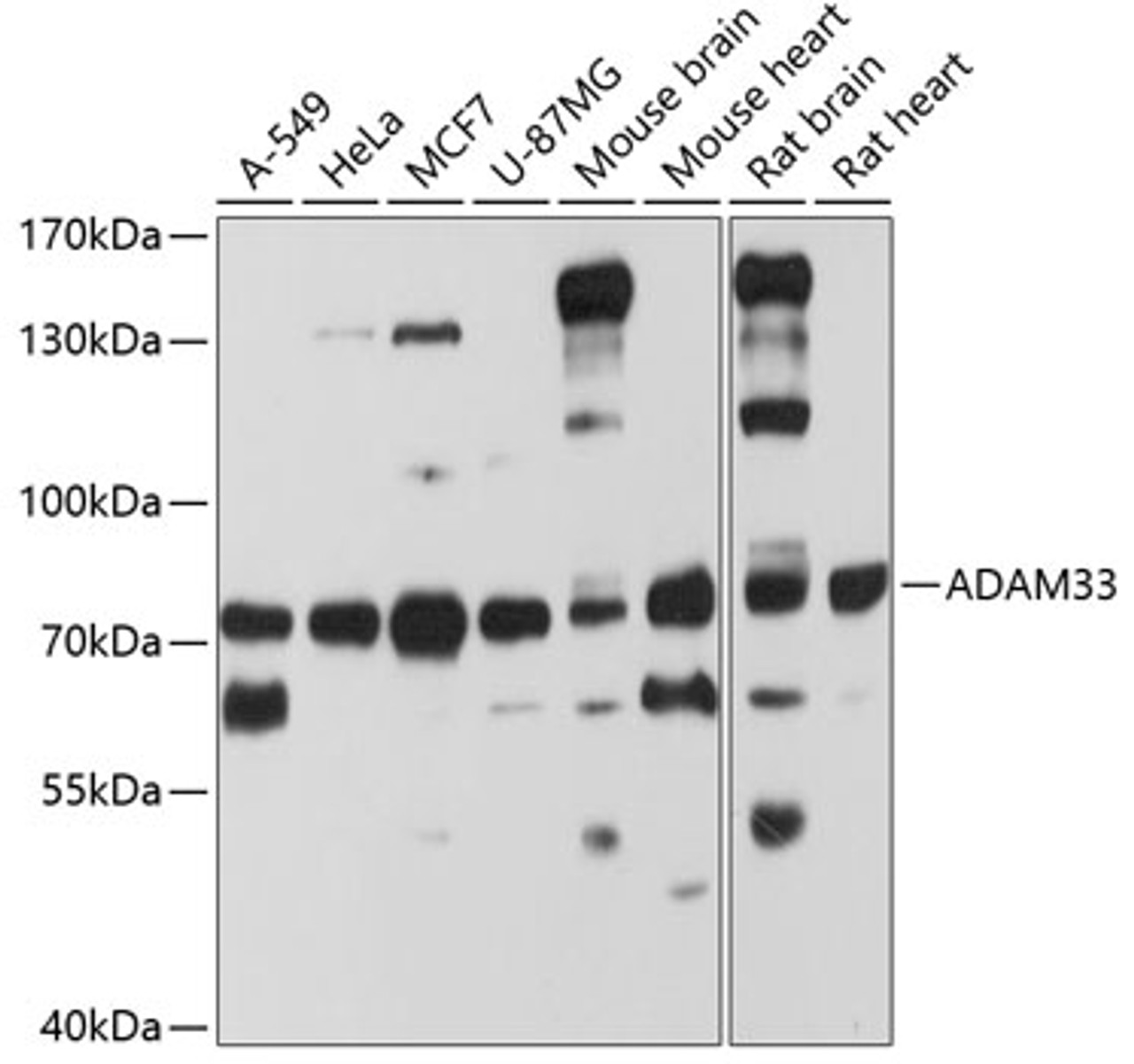 Western blot analysis of extracts of various cell lines, using ADAM33 antibody (23-483) at 1:1000 dilution.<br/>Secondary antibody: HRP Goat Anti-Rabbit IgG (H+L) at 1:10000 dilution.<br/>Lysates/proteins: 25ug per lane.<br/>Blocking buffer: 3% nonfat dry milk in TBST.<br/>Detection: ECL Basic Kit.<br/>Exposure time: 20s.