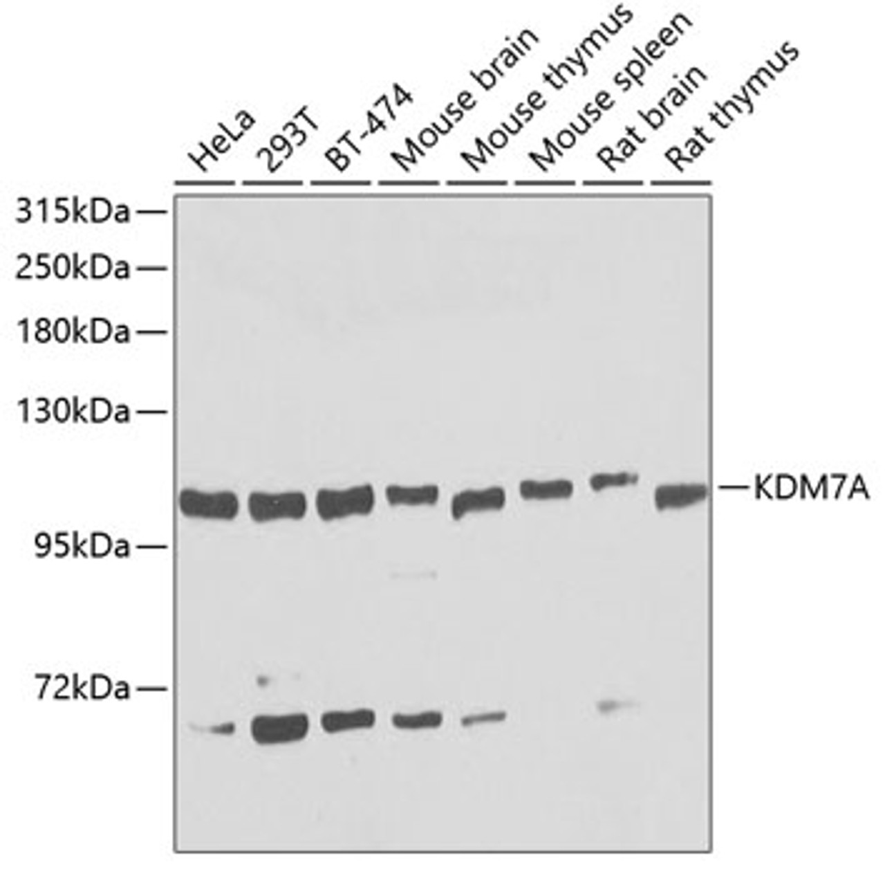 Western blot analysis of extracts of various cell lines, using KDM7A antibody (23-484) at 1:1000 dilution.<br/>Secondary antibody: HRP Goat Anti-Rabbit IgG (H+L) at 1:10000 dilution.<br/>Lysates/proteins: 25ug per lane.<br/>Blocking buffer: 3% nonfat dry milk in TBST.<br/>Detection: ECL Basic Kit.<br/>Exposure time: 30s.