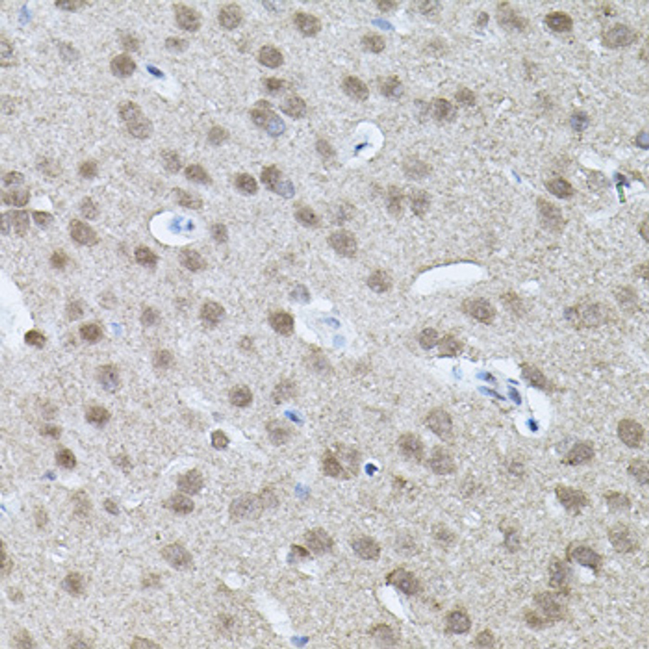 Immunohistochemistry of paraffin-embedded mouse brain using RNF166 antibody (23-487) (40x lens) .