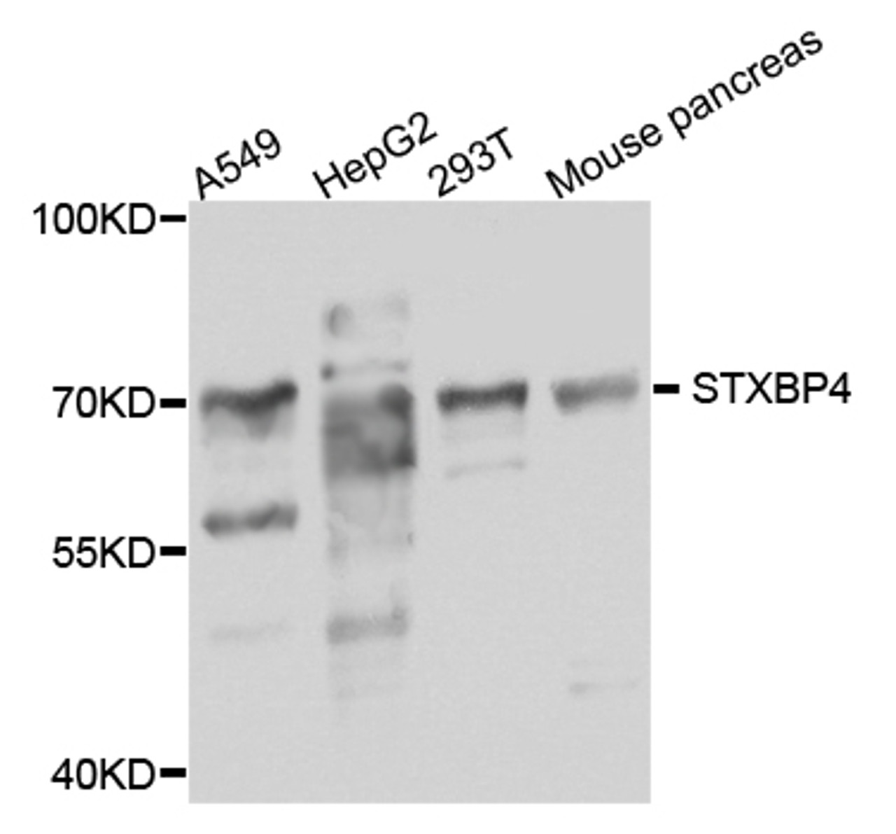 Western blot analysis of extracts of various cell lines, using STXBP4 antibody (23-490) at 1:1000 dilution.<br/>Secondary antibody: HRP Goat Anti-Rabbit IgG (H+L) at 1:10000 dilution.<br/>Lysates/proteins: 25ug per lane.<br/>Blocking buffer: 3% nonfat dry milk in TBST.<br/>Detection: ECL Basic Kit.<br/>Exposure time: 20s.