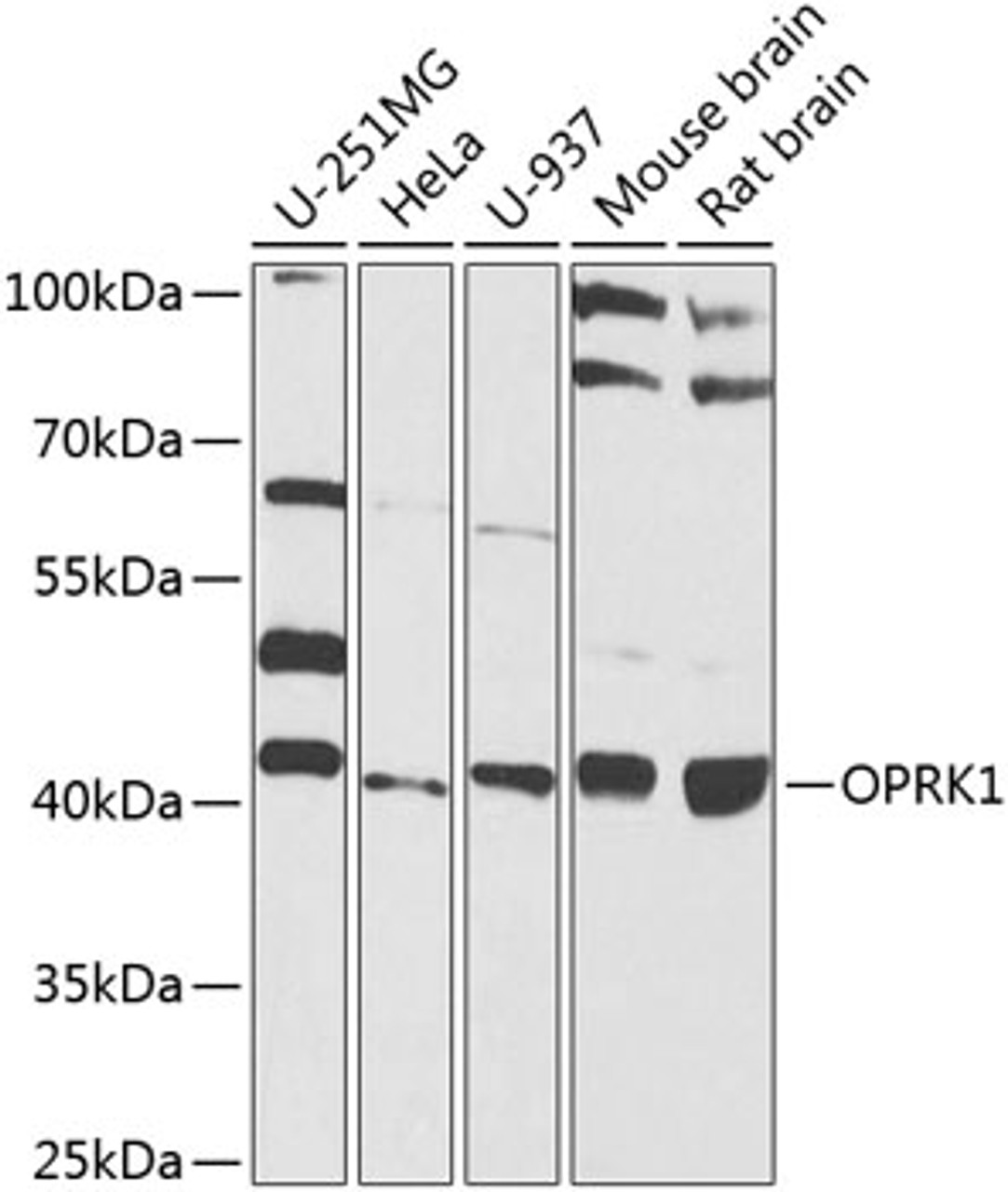 Western blot analysis of extracts of various cell lines, using OPRK1 antibody (23-499) at 1:1000 dilution.<br/>Secondary antibody: HRP Goat Anti-Rabbit IgG (H+L) at 1:10000 dilution.<br/>Lysates/proteins: 25ug per lane.<br/>Blocking buffer: 3% nonfat dry milk in TBST.<br/>Detection: ECL Basic Kit.<br/>Exposure time: 15s.