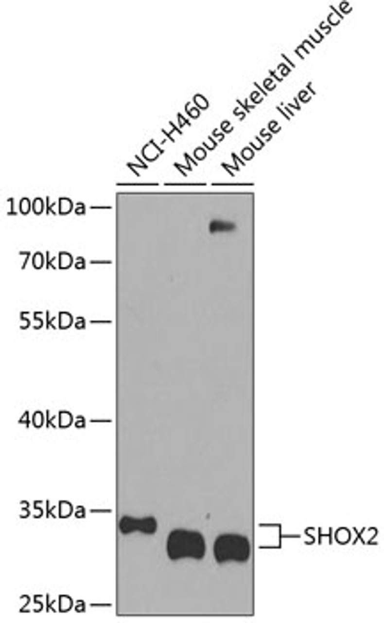 Western blot analysis of extracts of various cell lines, using SHOX2 antibody (23-501) at 1:1000 dilution.<br/>Secondary antibody: HRP Goat Anti-Rabbit IgG (H+L) at 1:10000 dilution.<br/>Lysates/proteins: 25ug per lane.<br/>Blocking buffer: 3% nonfat dry milk in TBST.<br/>Detection: ECL Basic Kit.<br/>Exposure time: 30s.