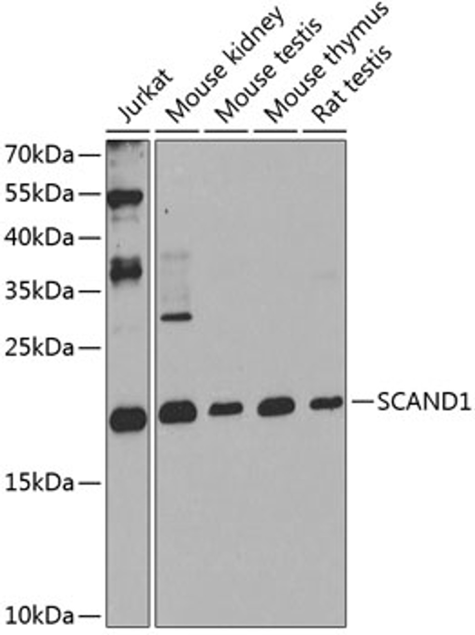 Western blot analysis of extracts of various cell lines, using SCAND1 antibody (23-502) at 1:1000 dilution.<br/>Secondary antibody: HRP Goat Anti-Rabbit IgG (H+L) at 1:10000 dilution.<br/>Lysates/proteins: 25ug per lane.<br/>Blocking buffer: 3% nonfat dry milk in TBST.<br/>Detection: ECL Enhanced Kit.<br/>Exposure time: 90s.