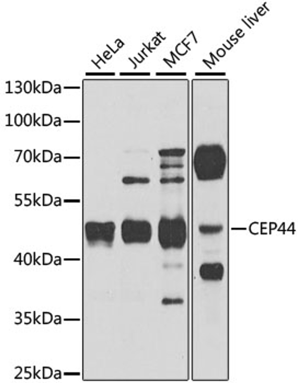 Western blot analysis of extracts of various cell lines, using CEP44 antibody (23-506) at 1:1000 dilution.<br/>Secondary antibody: HRP Goat Anti-Rabbit IgG (H+L) at 1:10000 dilution.<br/>Lysates/proteins: 25ug per lane.<br/>Blocking buffer: 3% nonfat dry milk in TBST.<br/>Detection: ECL Basic Kit.<br/>Exposure time: 60s.