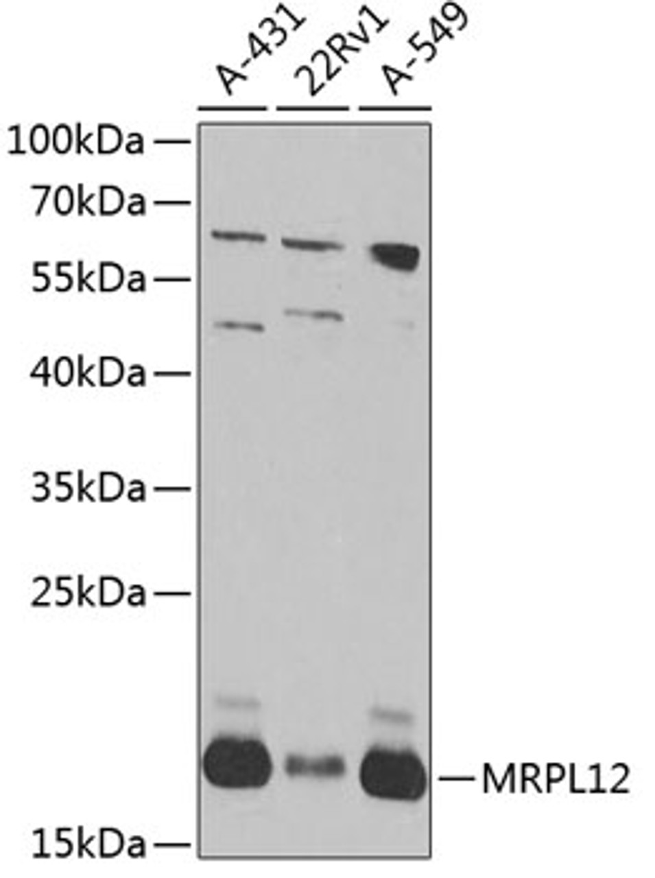 Western blot analysis of extracts of various cell lines, using MRPL12 antibody (23-507) at 1:1000 dilution.<br/>Secondary antibody: HRP Goat Anti-Rabbit IgG (H+L) at 1:10000 dilution.<br/>Lysates/proteins: 25ug per lane.<br/>Blocking buffer: 3% nonfat dry milk in TBST.<br/>Detection: ECL Basic Kit.<br/>Exposure time: 15s.