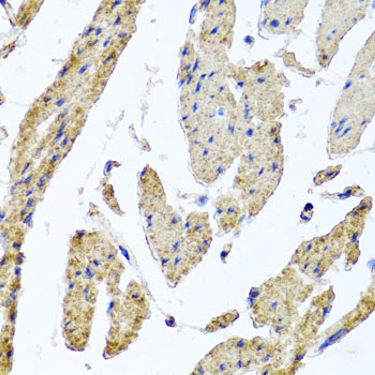 Immunohistochemistry of paraffin-embedded human esophageal smooth muscle using MRPL12 antibody (23-507) at dilution of 1:100 (40x lens) .