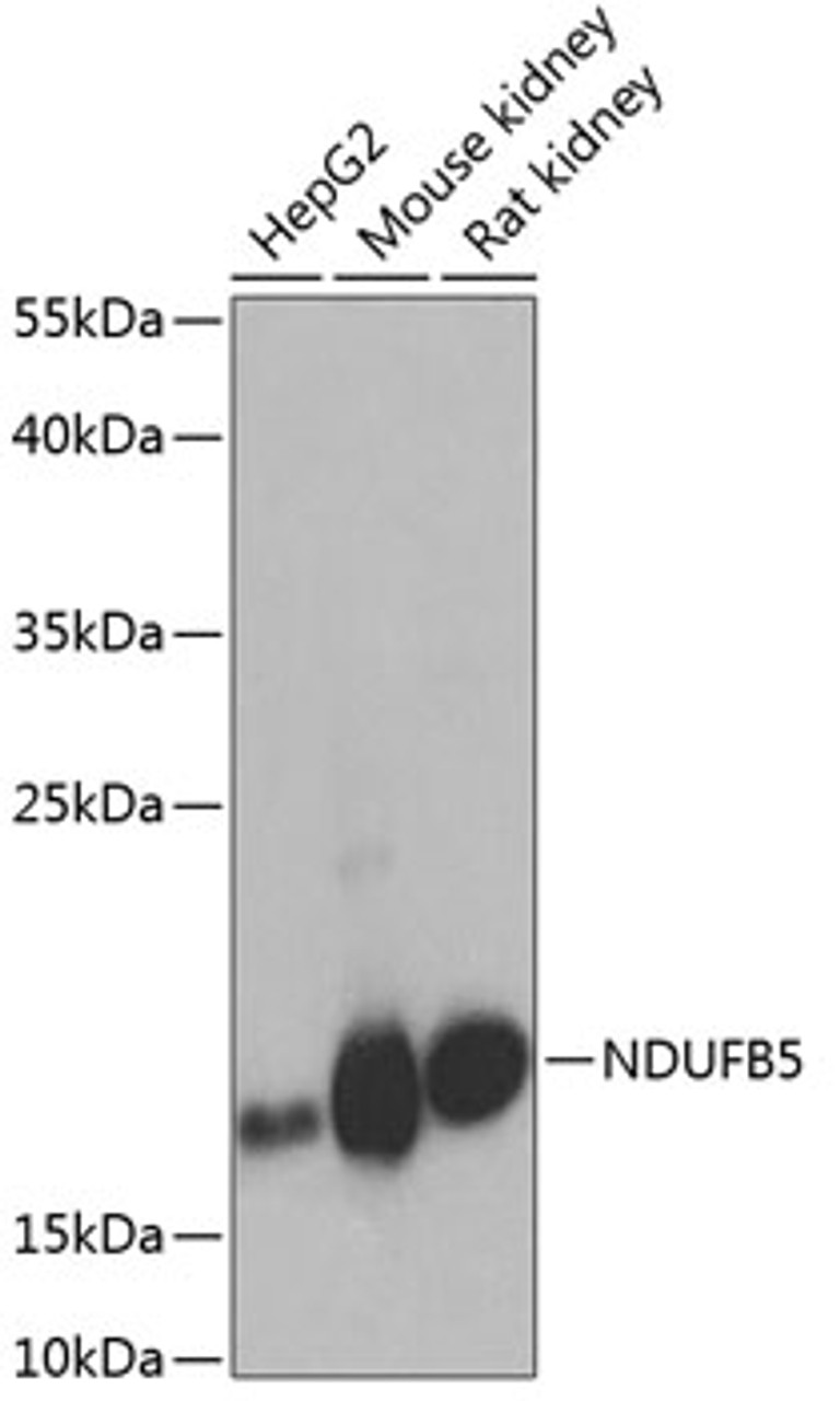 Western blot analysis of extracts of various cell lines, using NDUFB5 antibody (23-513) at 1:1000 dilution.<br/>Secondary antibody: HRP Goat Anti-Rabbit IgG (H+L) at 1:10000 dilution.<br/>Lysates/proteins: 25ug per lane.<br/>Blocking buffer: 3% nonfat dry milk in TBST.<br/>Detection: ECL Enhanced Kit.<br/>Exposure time: 10s.