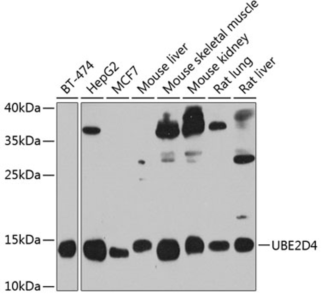 Western blot analysis of extracts of various cell lines, using UBE2D4 antibody (23-516) at 1:1000 dilution.<br/>Secondary antibody: HRP Goat Anti-Rabbit IgG (H+L) at 1:10000 dilution.<br/>Lysates/proteins: 25ug per lane.<br/>Blocking buffer: 3% nonfat dry milk in TBST.<br/>Detection: ECL Enhanced Kit.<br/>Exposure time: 30s.