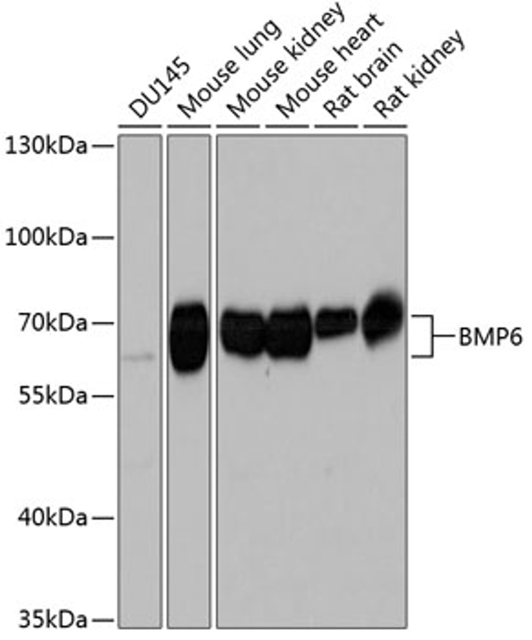 Western blot analysis of extracts of various cell lines, using BMP6 Antibody (23-517) at 1:1000 dilution.<br/>Secondary antibody: HRP Goat Anti-Rabbit IgG (H+L) at 1:10000 dilution.<br/>Lysates/proteins: 25ug per lane.<br/>Blocking buffer: 3% nonfat dry milk in TBST.<br/>Detection: ECL Basic Kit.<br/>Exposure time: 10s.