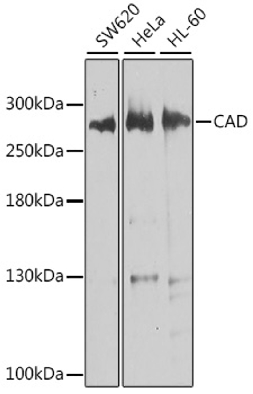 Western blot analysis of extracts of various cell lines, using CAD antibody (23-521) at 1:1000 dilution.<br/>Secondary antibody: HRP Goat Anti-Rabbit IgG (H+L) at 1:10000 dilution.<br/>Lysates/proteins: 25ug per lane.<br/>Blocking buffer: 3% nonfat dry milk in TBST.<br/>Detection: ECL Basic Kit.<br/>Exposure time: 10s.