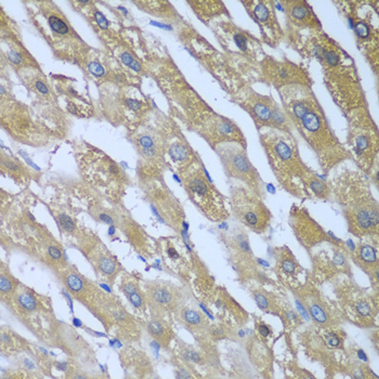 Immunohistochemistry of paraffin-embedded human liver using CAD antibody (23-521) at dilution of 1:100 (40x lens) .